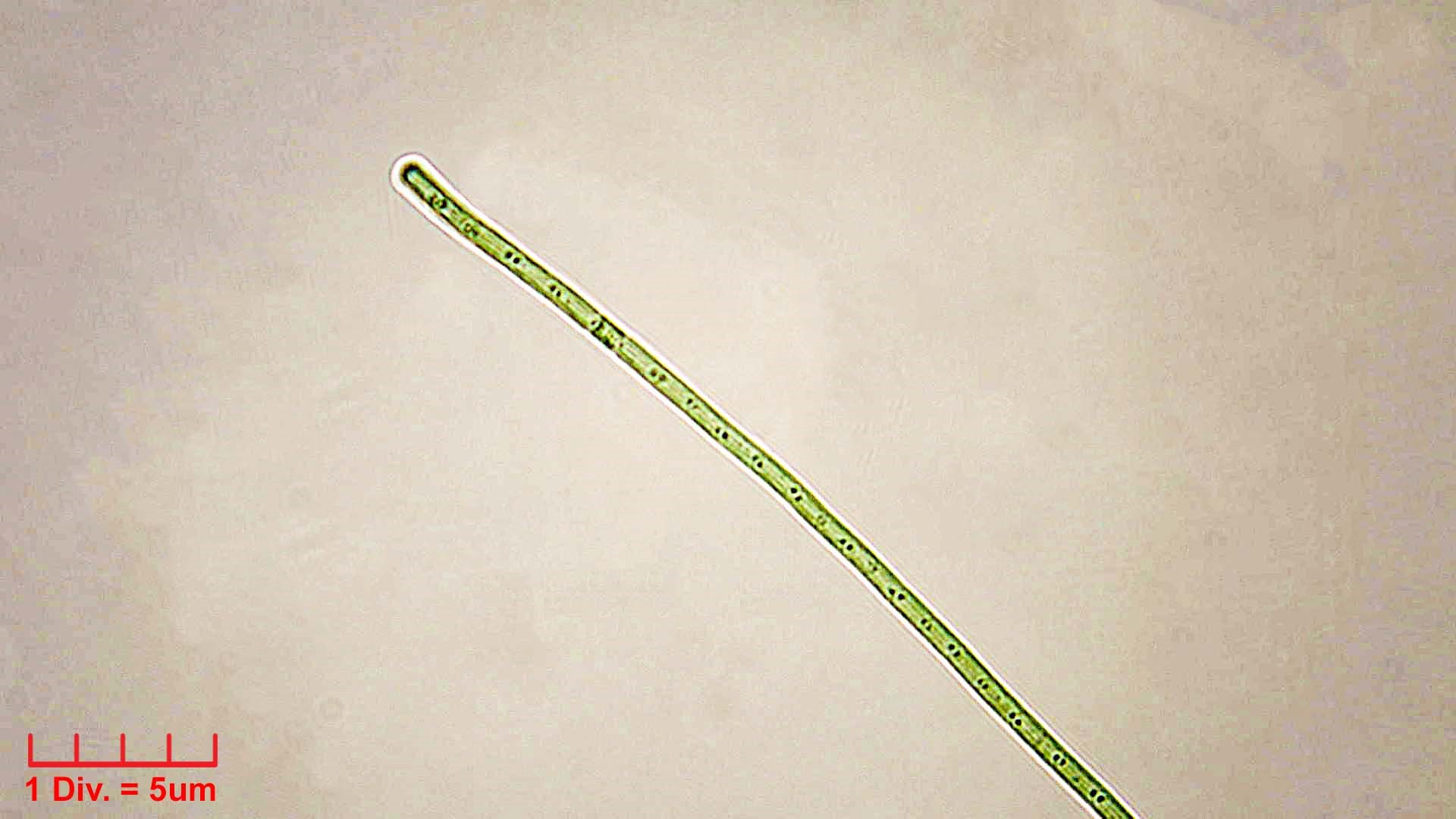 ././Cyanobacteria/Synechococcales/Pseudanabaenaceae/Limnothrix/redekei/limnothrix-redekei-139.jpg