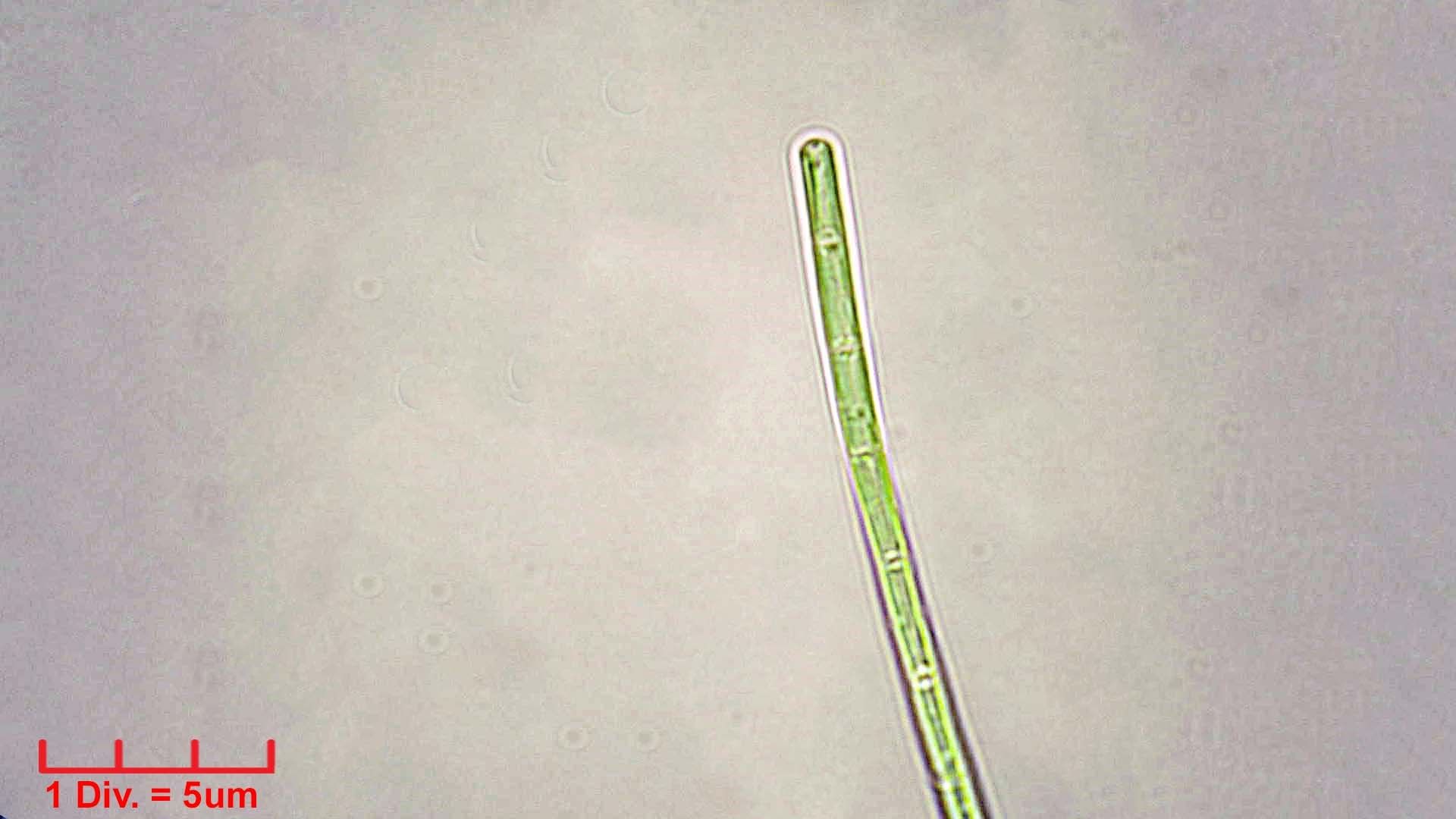 ././Cyanobacteria/Synechococcales/Pseudanabaenaceae/Limnothrix/redekei/limnothrix-redekei-140.jpg