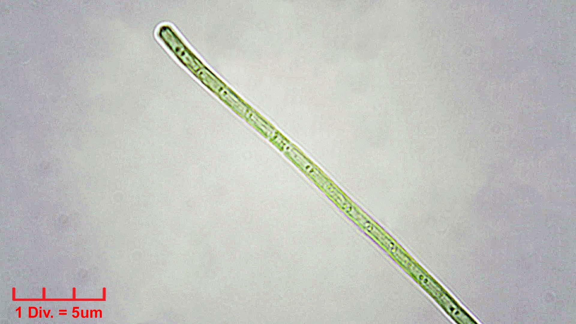 ./Cyanobacteria/Synechococcales/Pseudanabaenaceae/Limnothrix/redekei/limnothrix-redekei-141.jpg