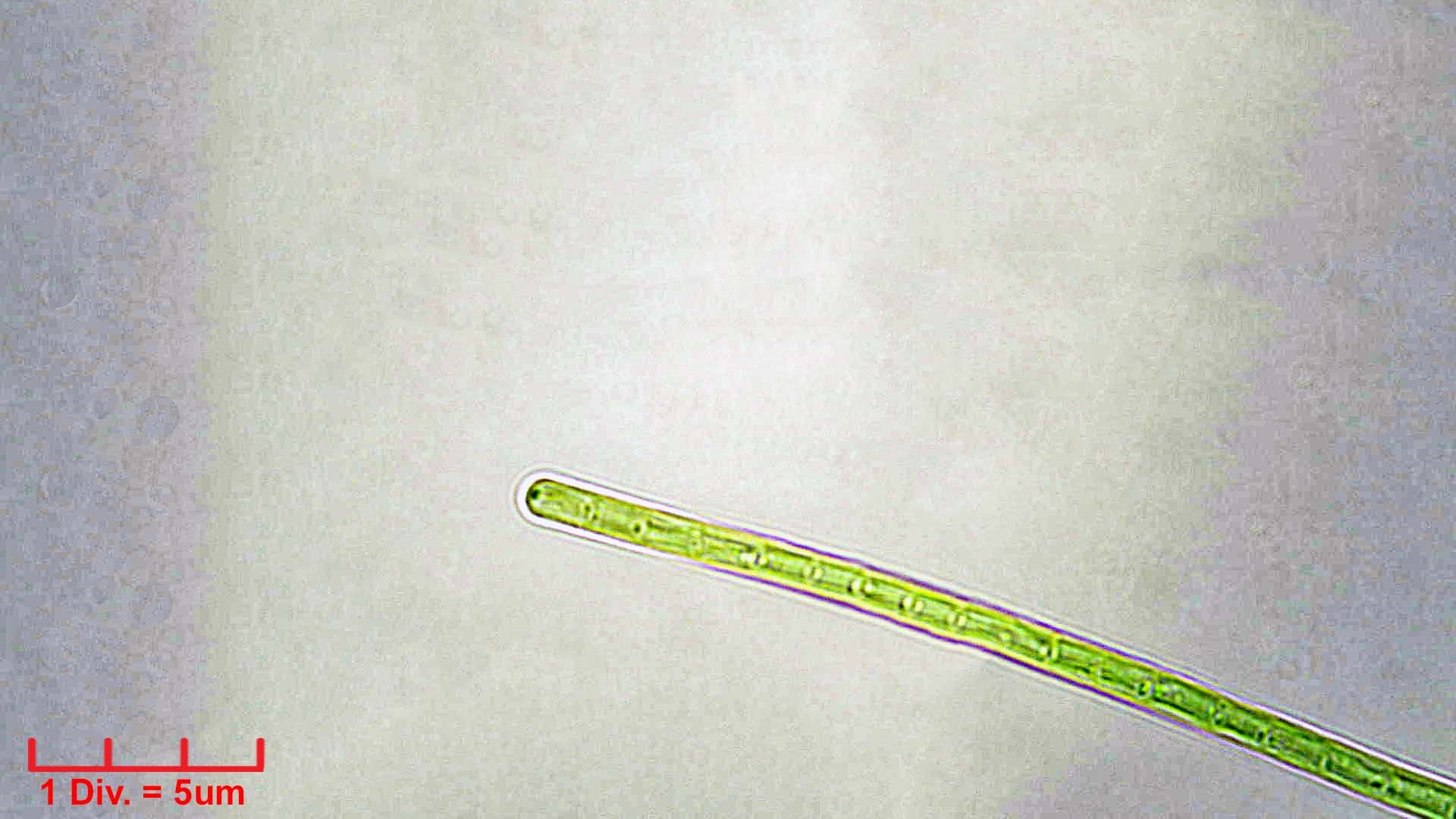 ././Cyanobacteria/Synechococcales/Pseudanabaenaceae/Limnothrix/redekei/limnothrix-redekei-142.jpg