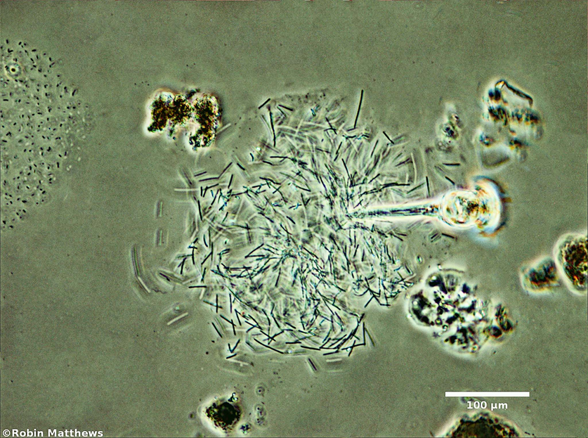 ././Cyanobacteria/Synechococcales/Pseudanabaenaceae/Pseudanabaena/arcuata/pseudanabaena-arcuata-132.png