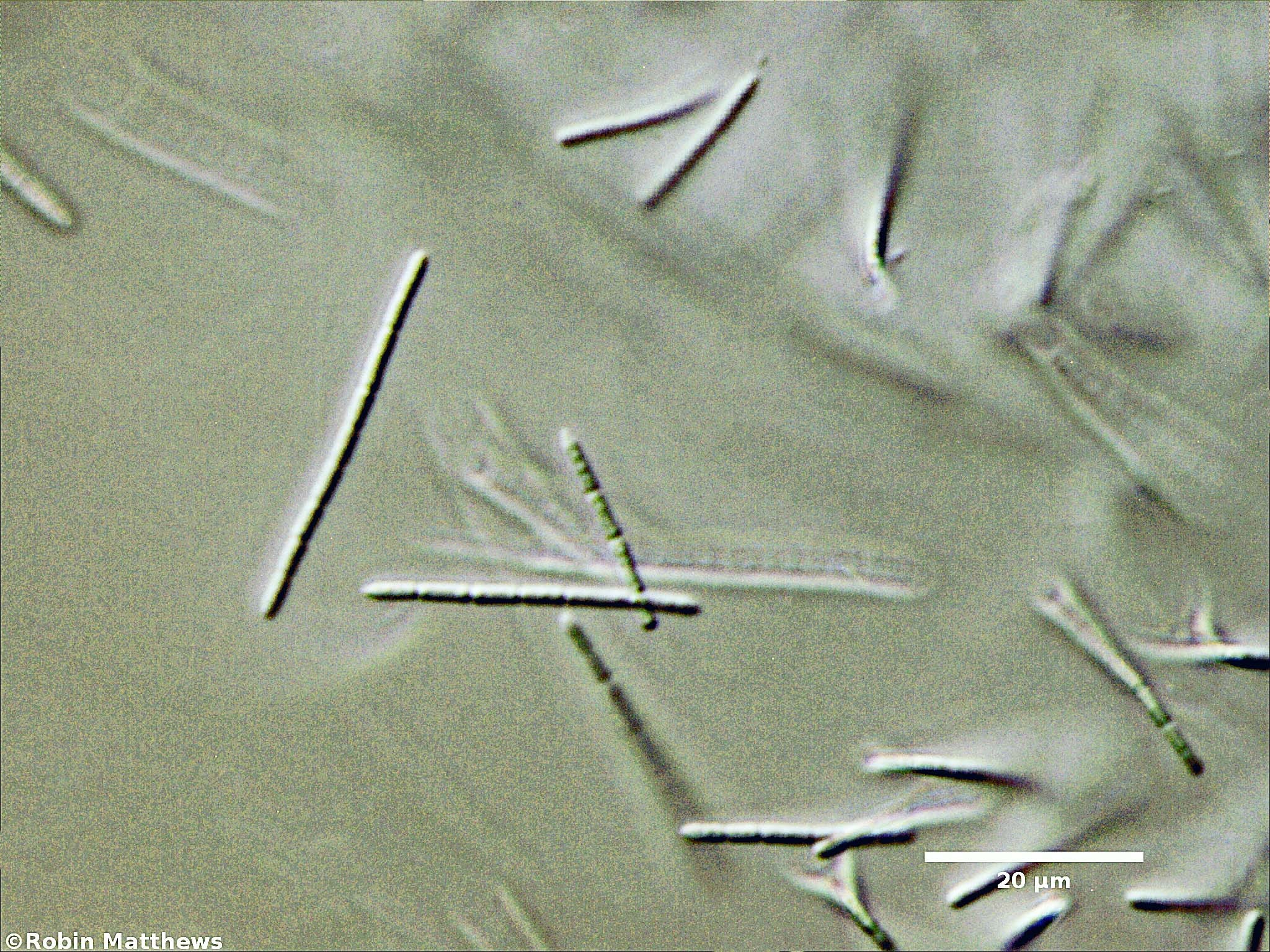././Cyanobacteria/Synechococcales/Pseudanabaenaceae/Pseudanabaena/arcuata/pseudanabaena-arcuata-133.jpg