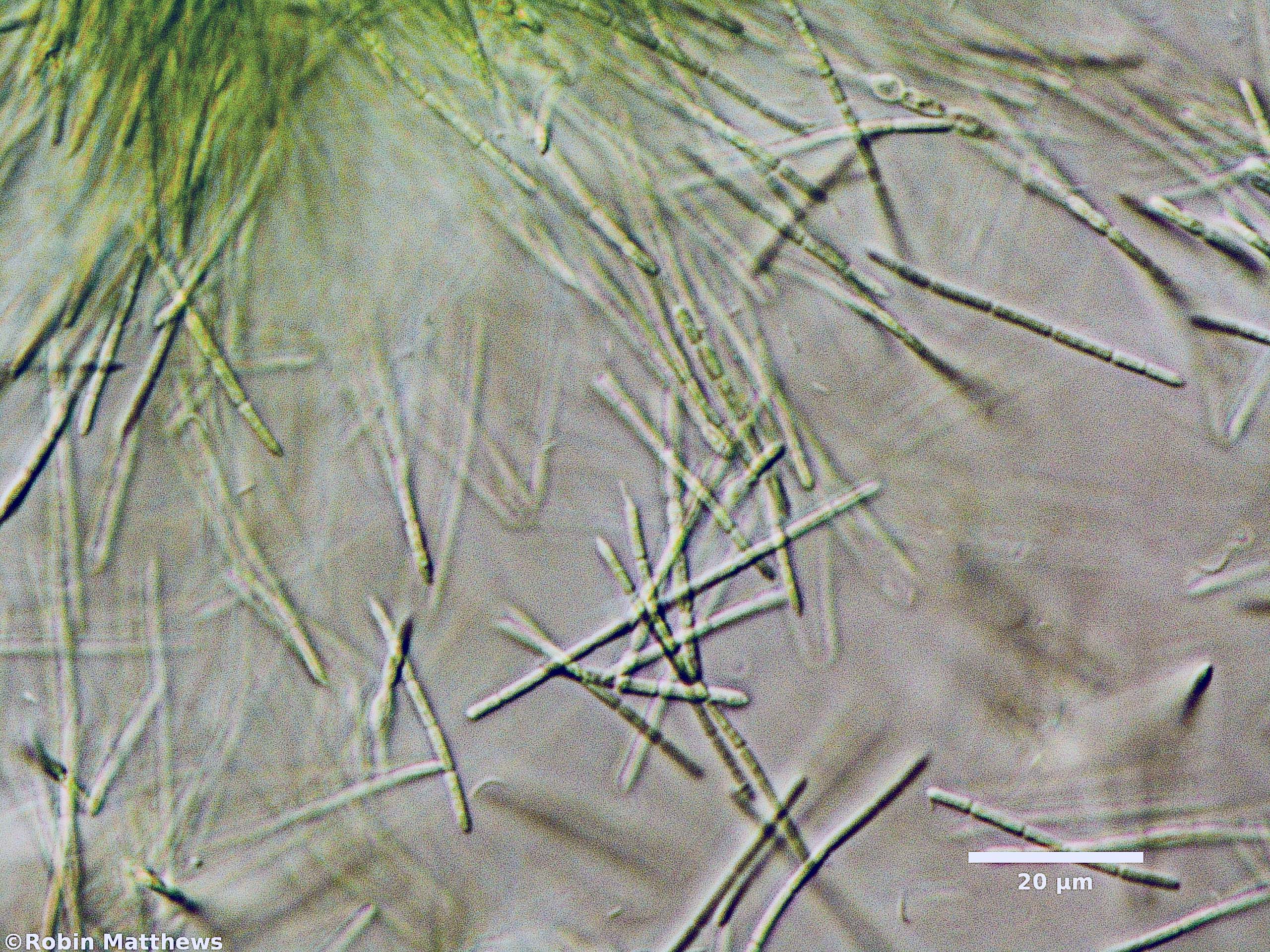 ././Cyanobacteria/Synechococcales/Pseudanabaenaceae/Pseudanabaena/sp/pseudanabaena-131.jpg