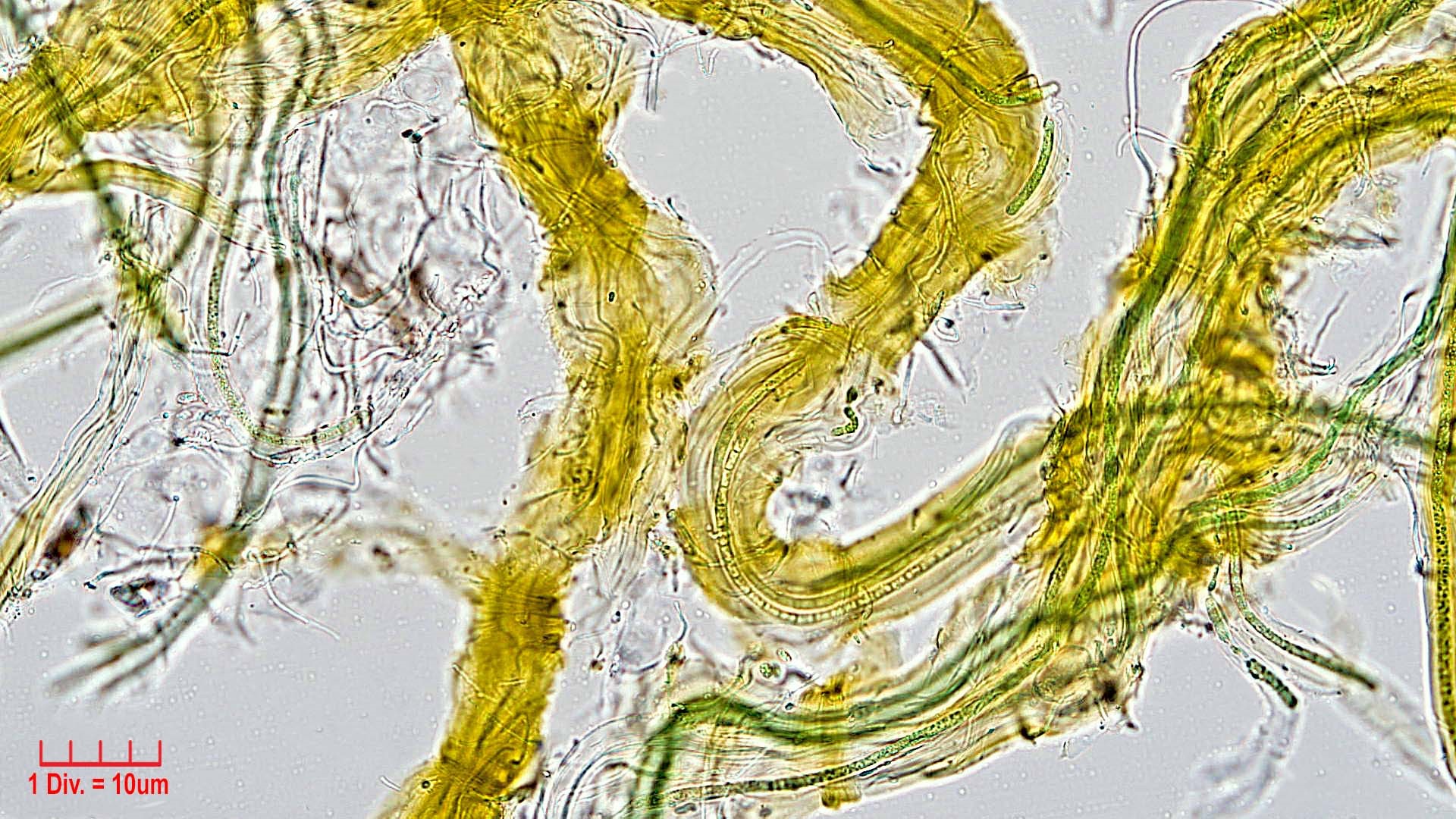 ././Cyanobacteria/Synechococcales/Schizotrichaceae/Dasygloea/lamyi/dasygloea-lamyi-144.jpg