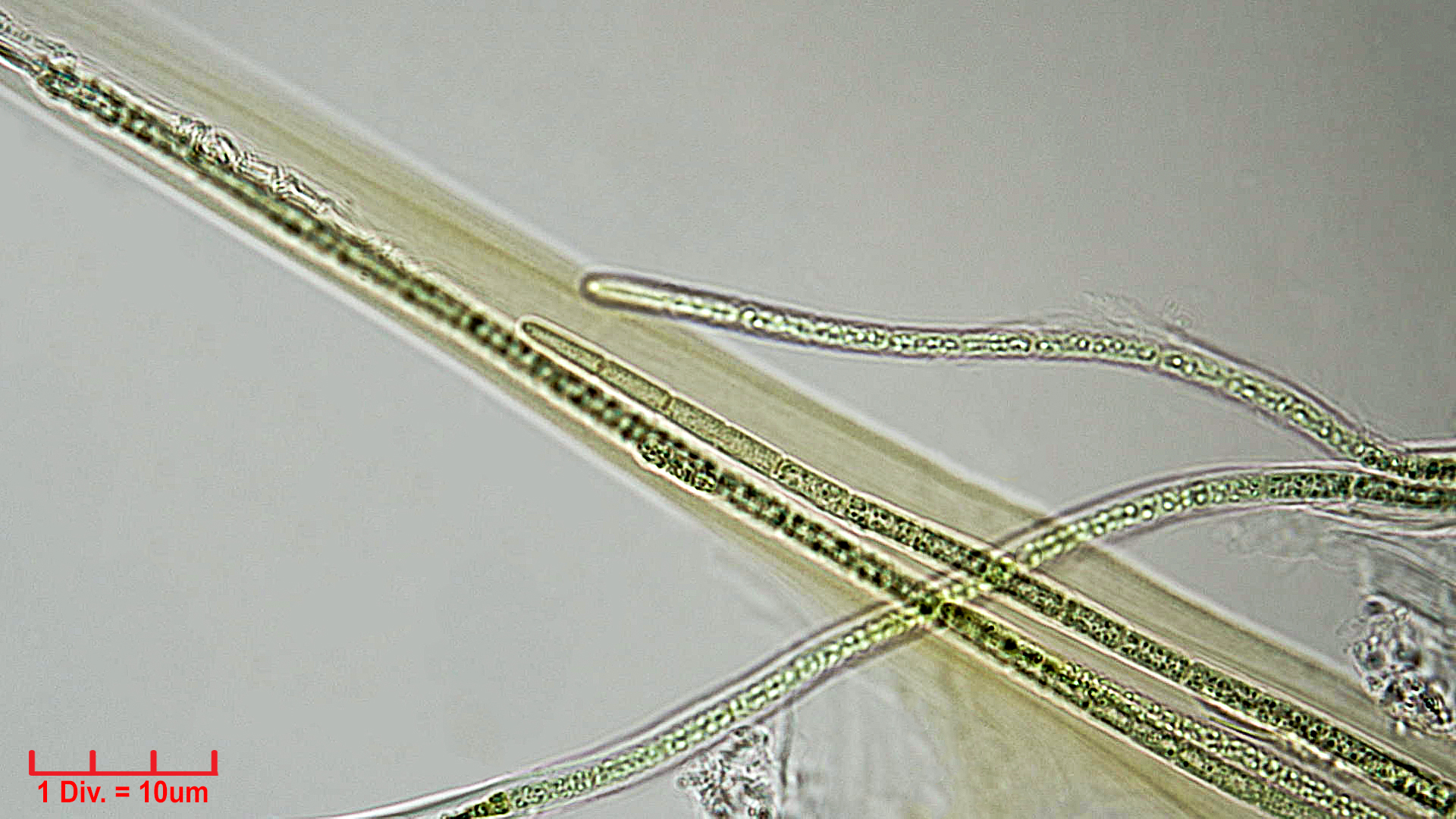 ././Cyanobacteria/Synechococcales/Schizotrichaceae/Dasygloea/lamyi/dasygloea-lamyi-2.jpg