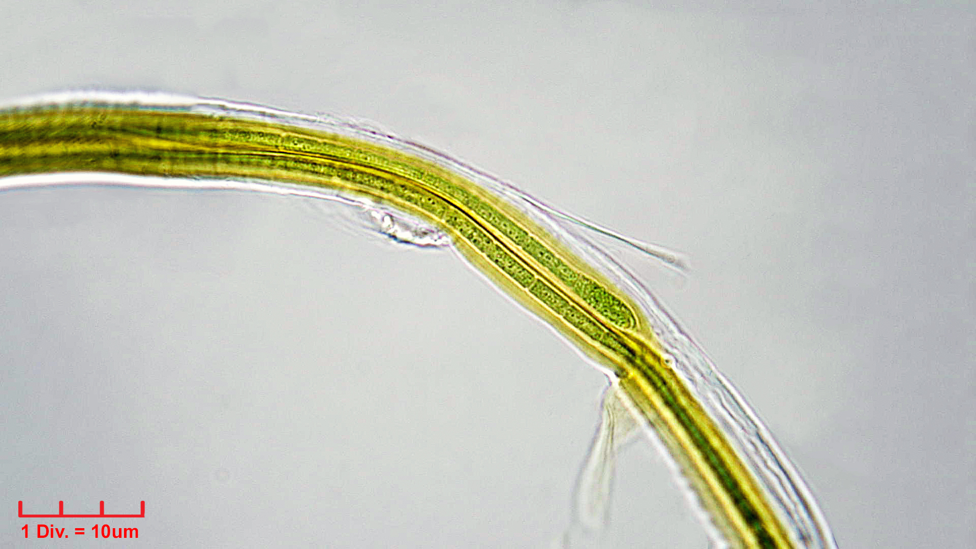 ././Cyanobacteria/Synechococcales/Schizotrichaceae/Dasygloea/lamyi/dasygloea-lamyi-3.jpg