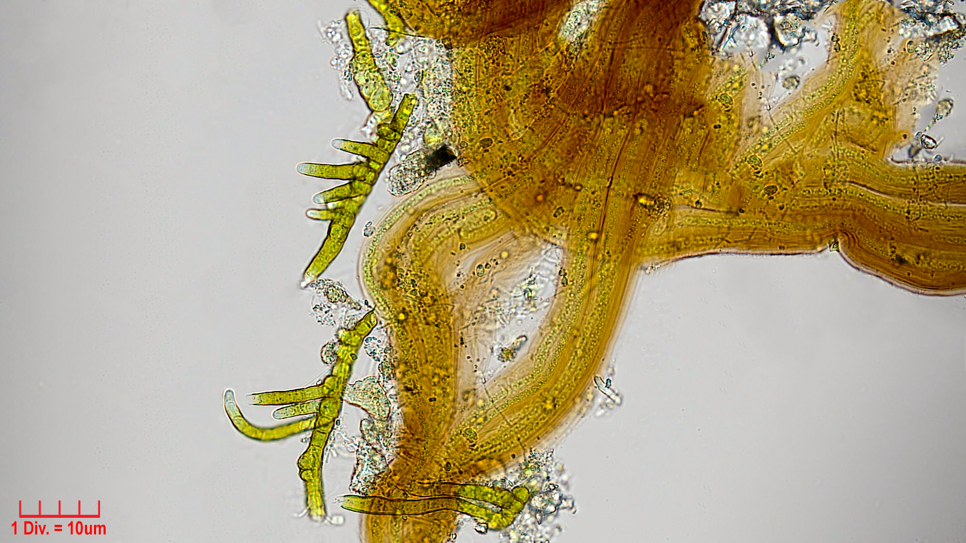././Cyanobacteria/Synechococcales/Schizotrichaceae/Dasygloea/lamyi/dasygloea-lamyi-7.jpg