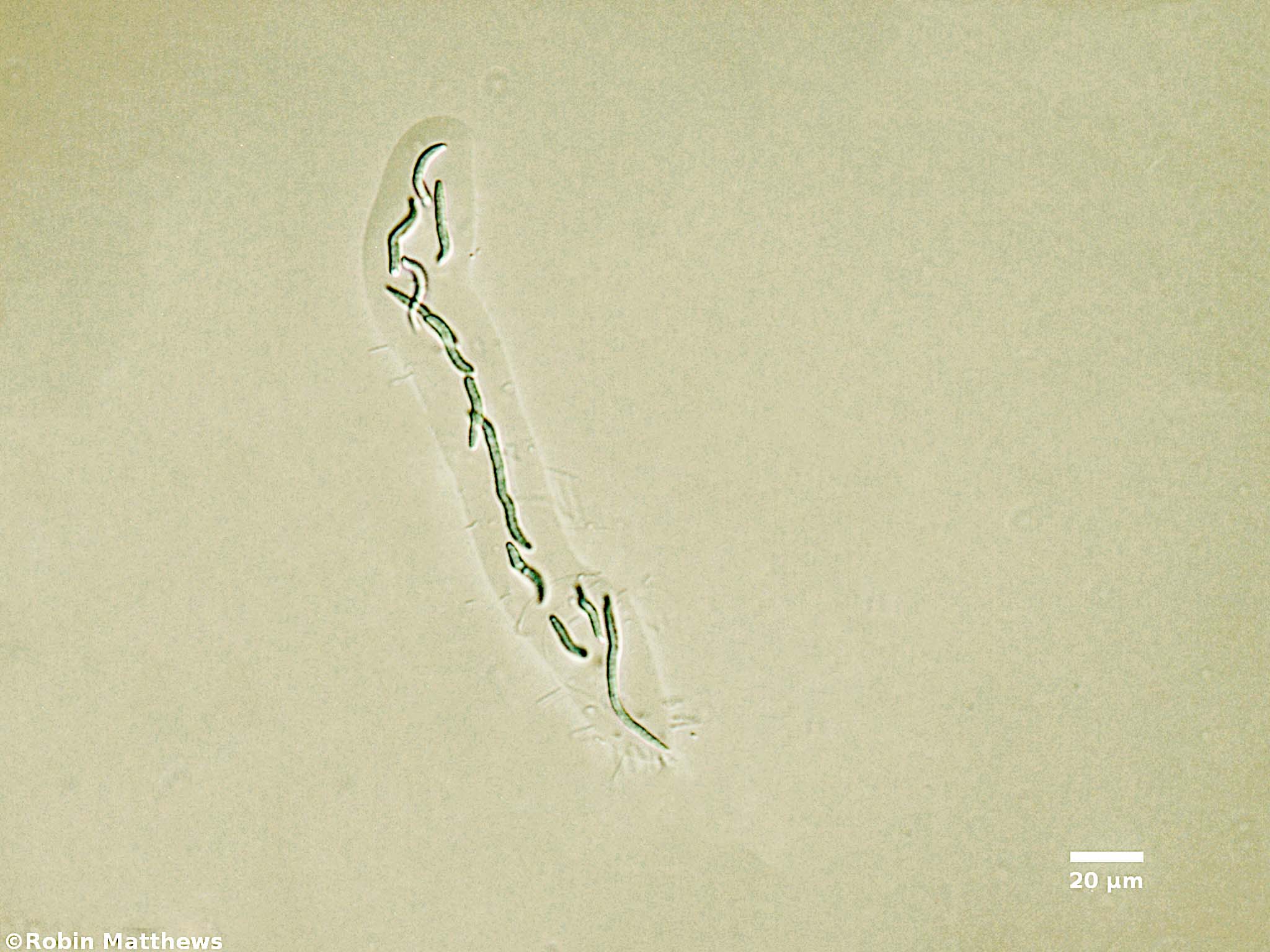 ././Cyanobacteria/Synechococcales/Synechococcaceae/Rhabdoderma/lineare/rhabdoderma-lineare-69.jpg