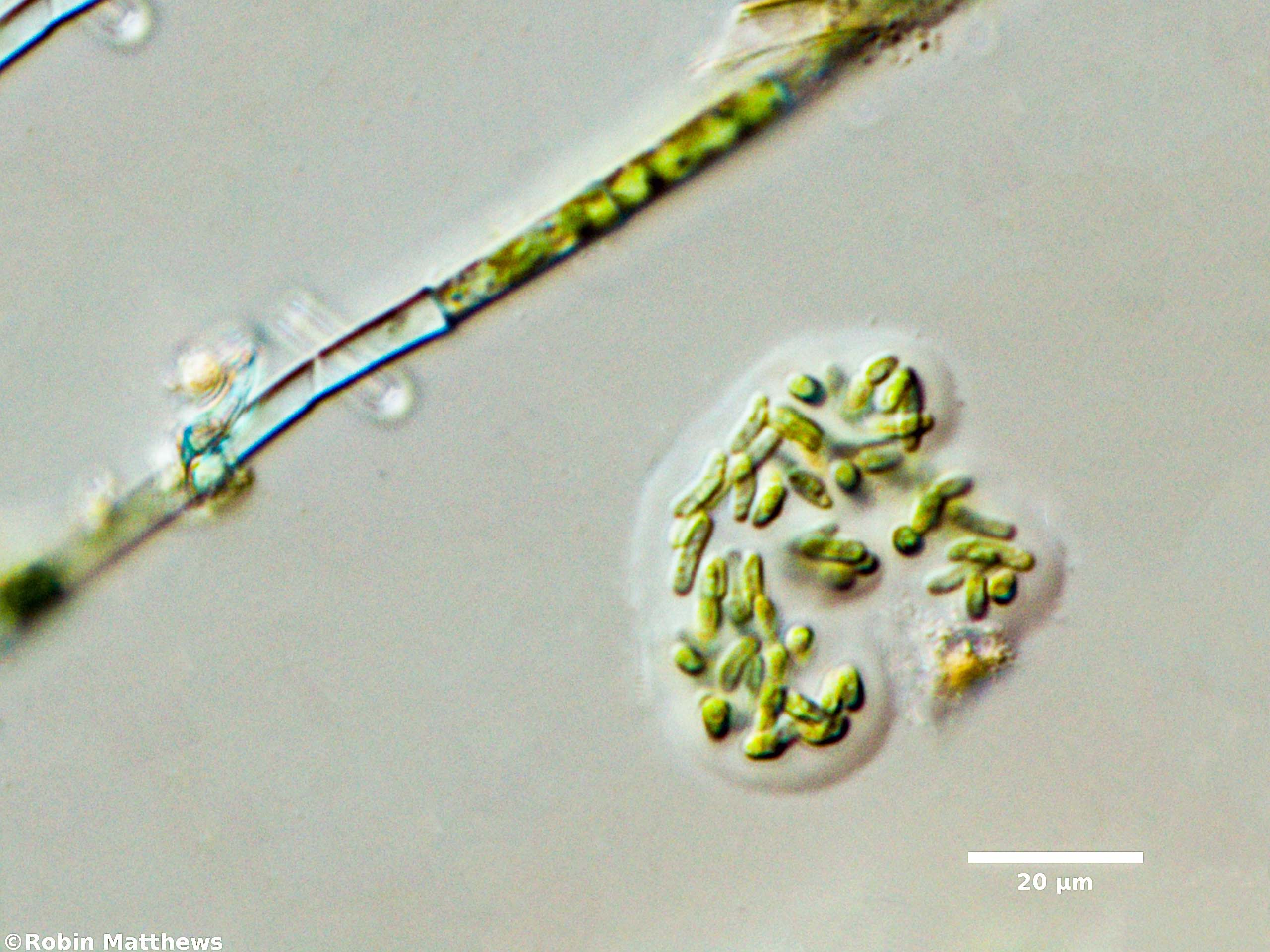 ./Cyanobacteria/Synechococcales/Synechococcaceae/Rhabdogloea/linearis/rhabdogloea-linearis-72.jpg