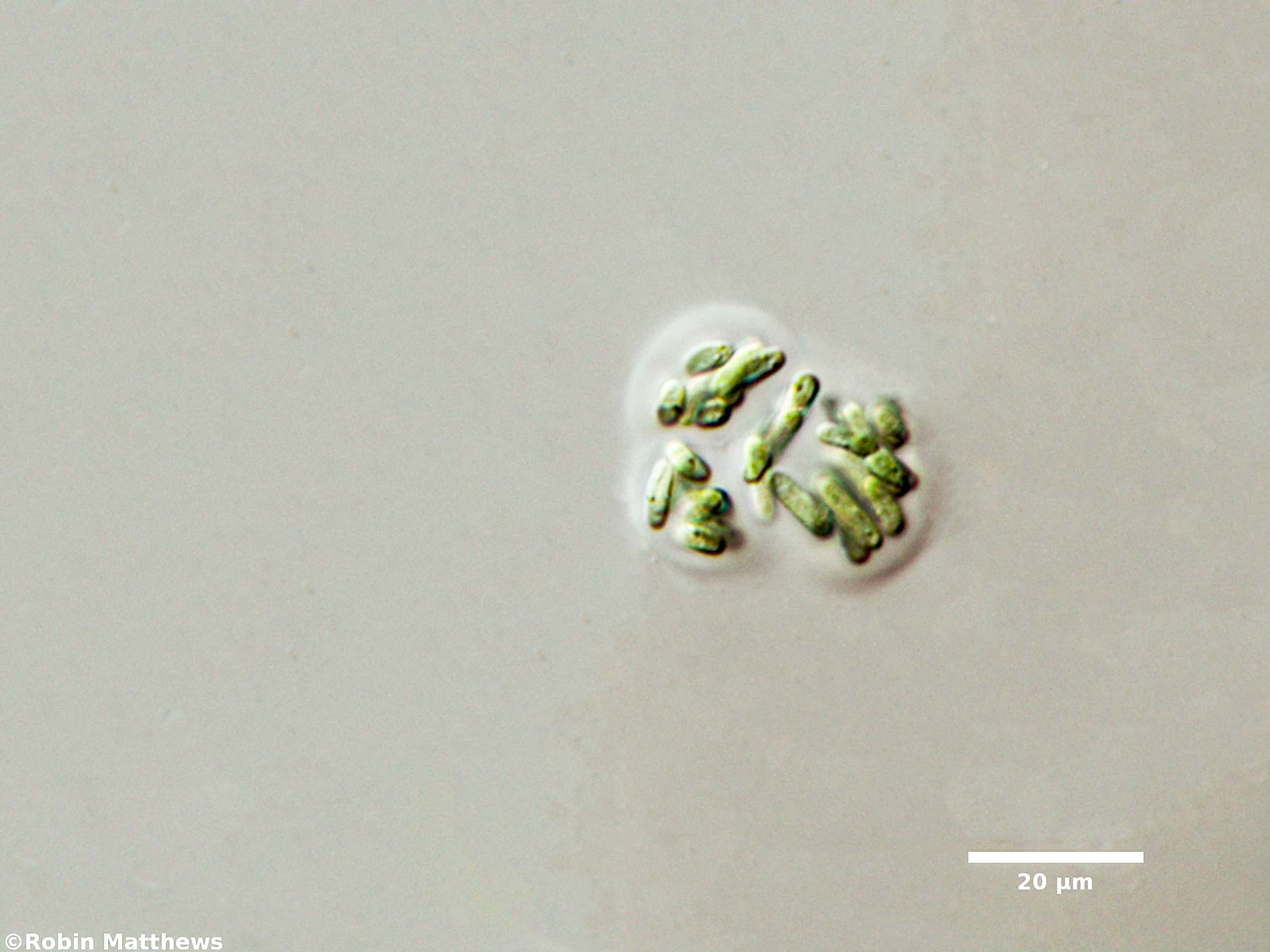 ./Cyanobacteria/Synechococcales/Synechococcaceae/Rhabdogloea/linearis/rhabdogloea-linearis-73.jpg