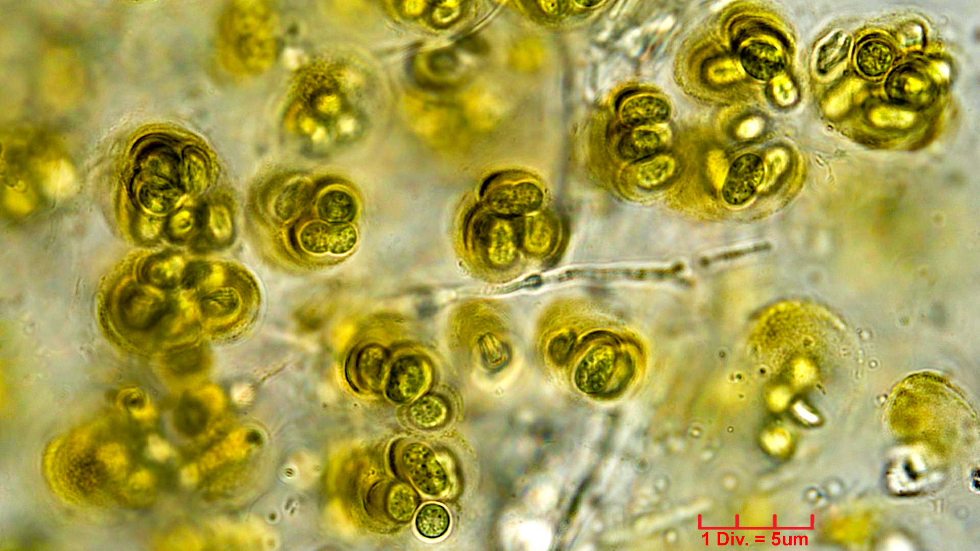 ././Cyanobacteria/Chroococcales/Aphanothecaceae/Gloeothece/fusco-lutea/gloeothece-fusco-lutea-14.jpg