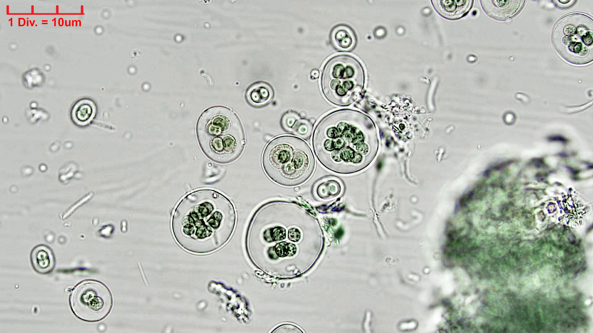 ./Cyanobacteria/Chroococcales/Chroococcaceae/Gloeocapsa/atrata/gloeocapsa-atrata-35.jpg
