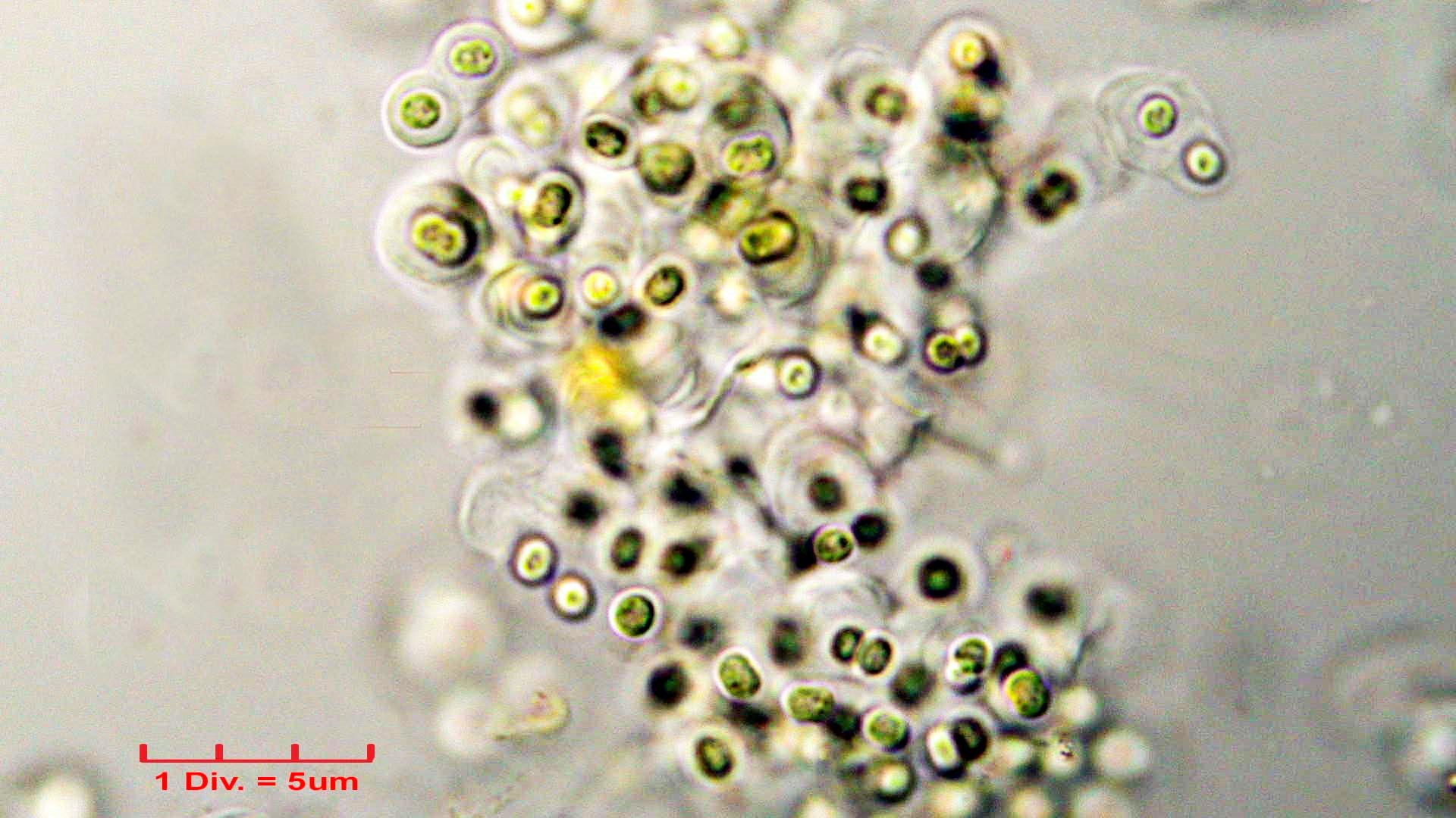 ./././Cyanobacteria/Chroococcales/Chroococcaceae/Gloeocapsa/biformis/gloeocapsa-biformis-39.jpg