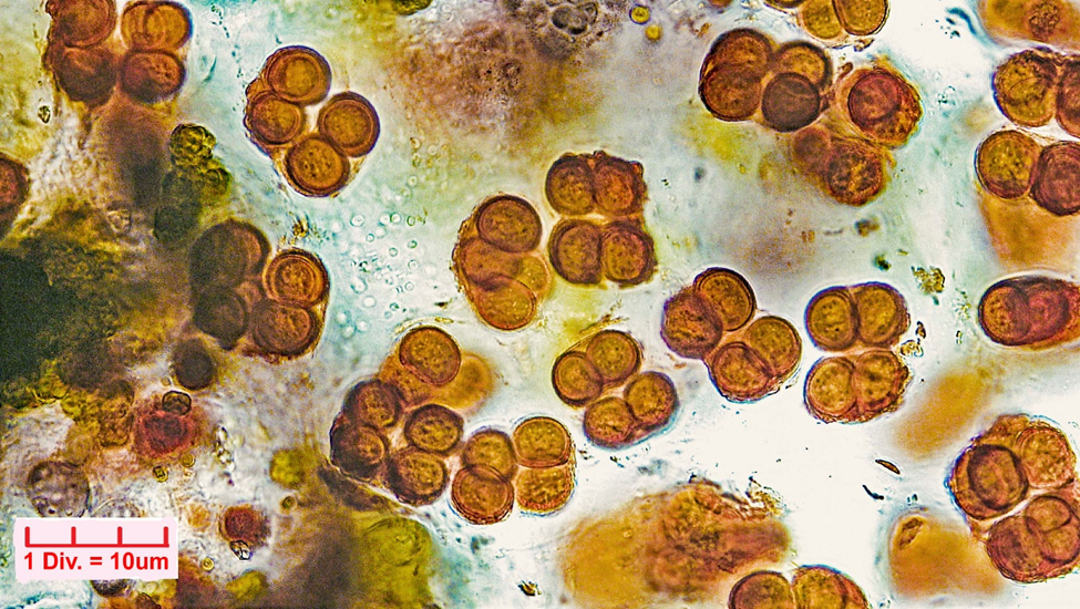 ././Cyanobacteria/Chroococcales/Chroococcaceae/Gloeocapsa/rupestris/gloeocapsa-rupestris-36.png