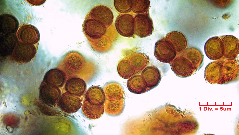 Cyanobacteria/Chroococcales/Chroococcaceae/Gloeocapsa/rupestris/gloeocapsa-rupestris-37.png
