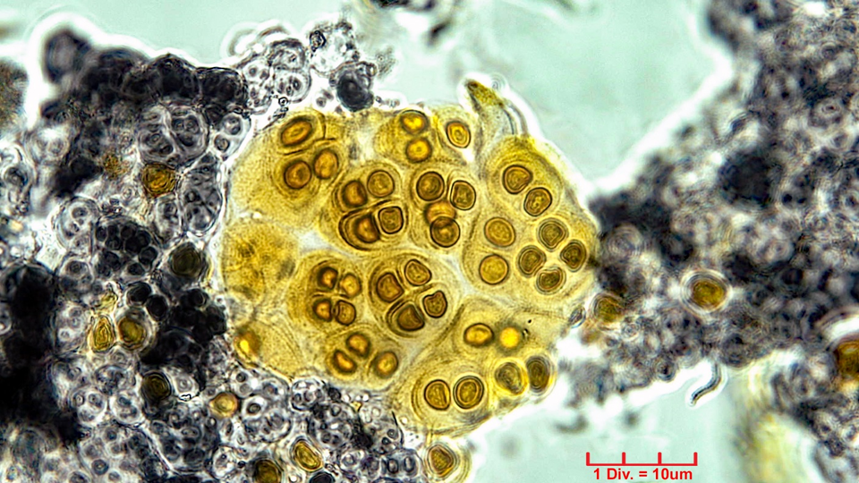 Cyanobacteria/Chroococcales/Chroococcaceae/Gloeocapsopsis/pleurocapsoides/gloeocapsopsis-pleurocapsoides-52.png
