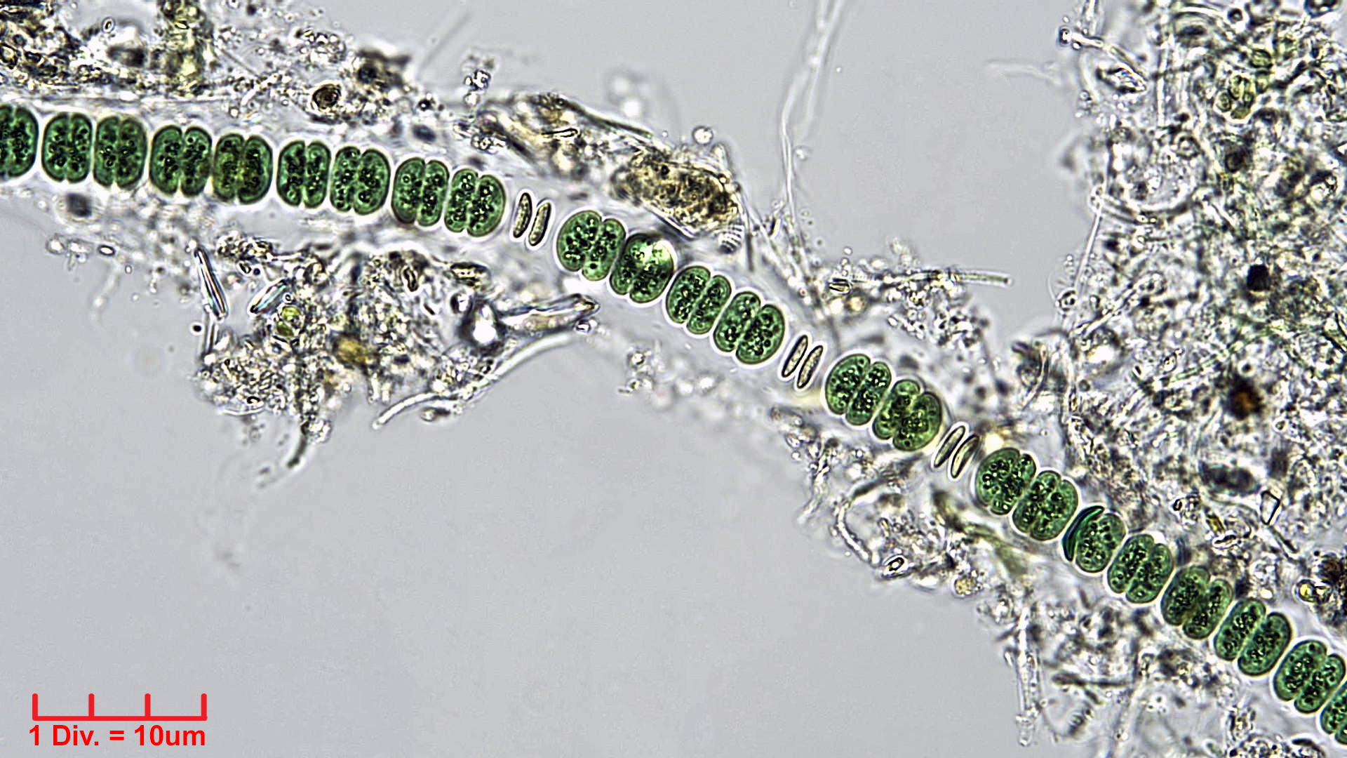 Cyanobacteria/Chroococcales/Cyanothricaceae/Johannesbaptistia/sp/johannesbaptistia-3.jpg