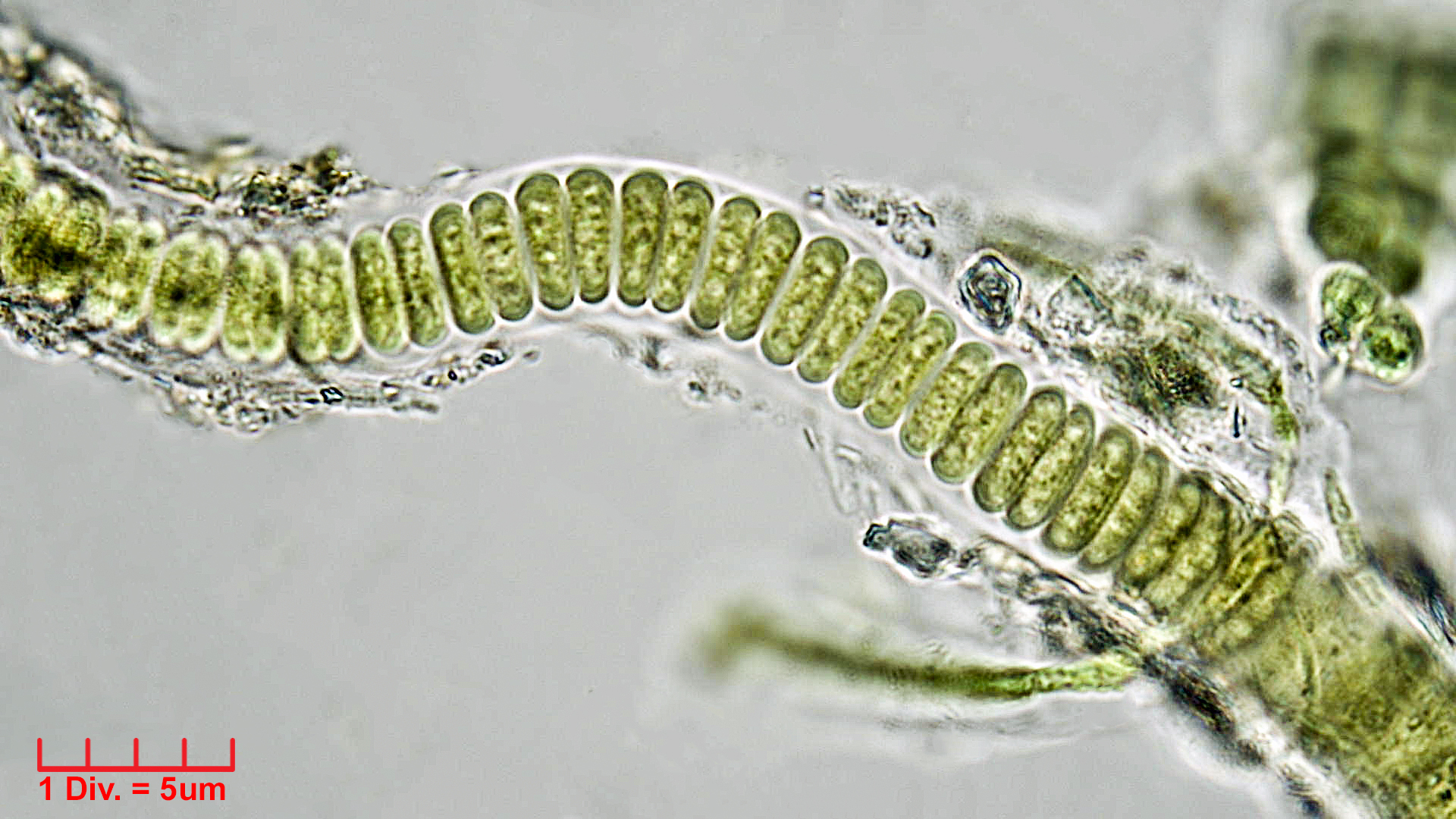 Cyanobacteria/Chroococcales/Cyanothricaceae/Johannesbaptistia/sp/johannesbaptistia-6.jpg