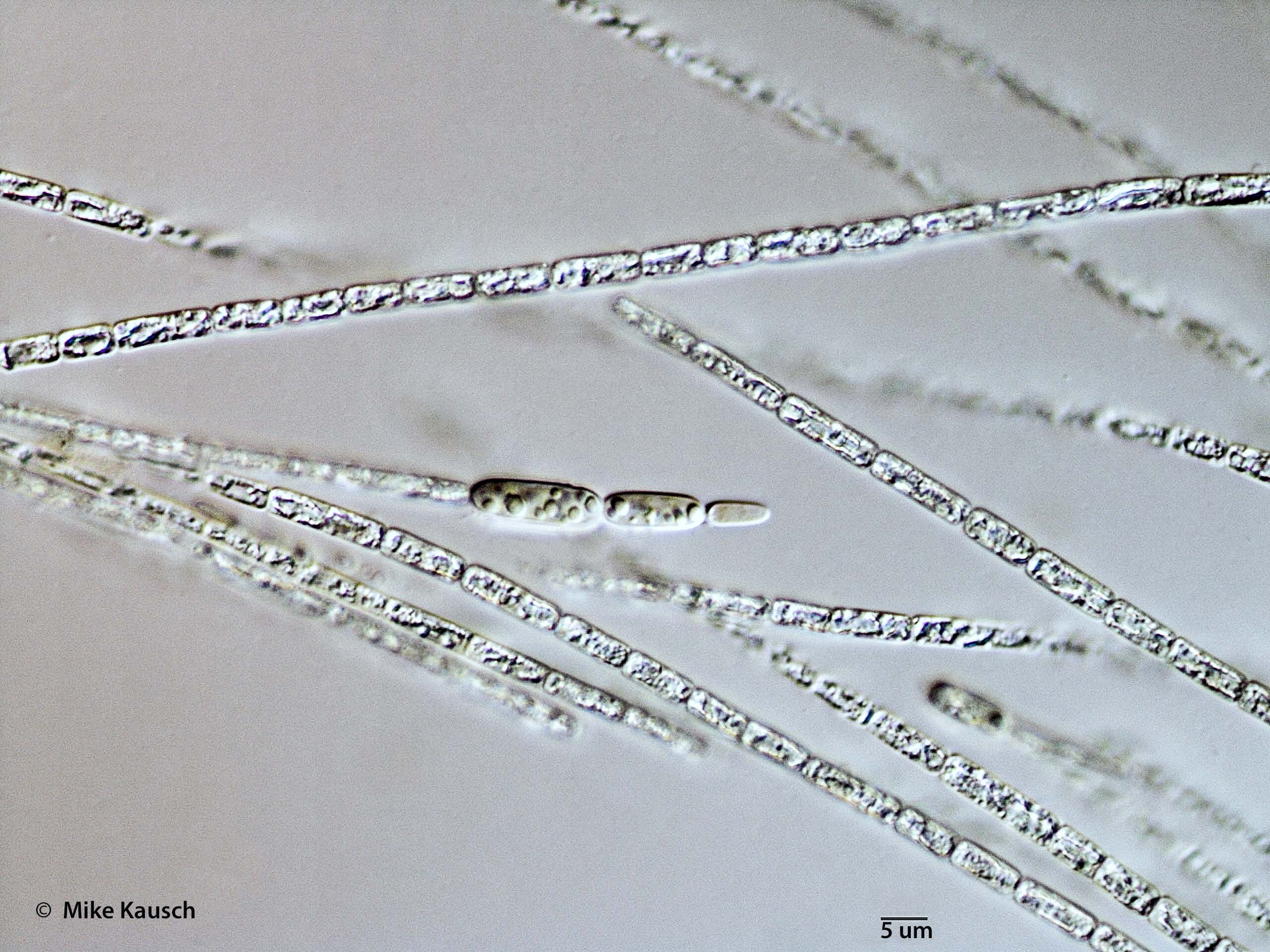 ./././Cyanobacteria/Nostocales/Aphanizomenonaceae/Cylindrospermopsis/raciborskii/cylindrospermopsis-582.jpg