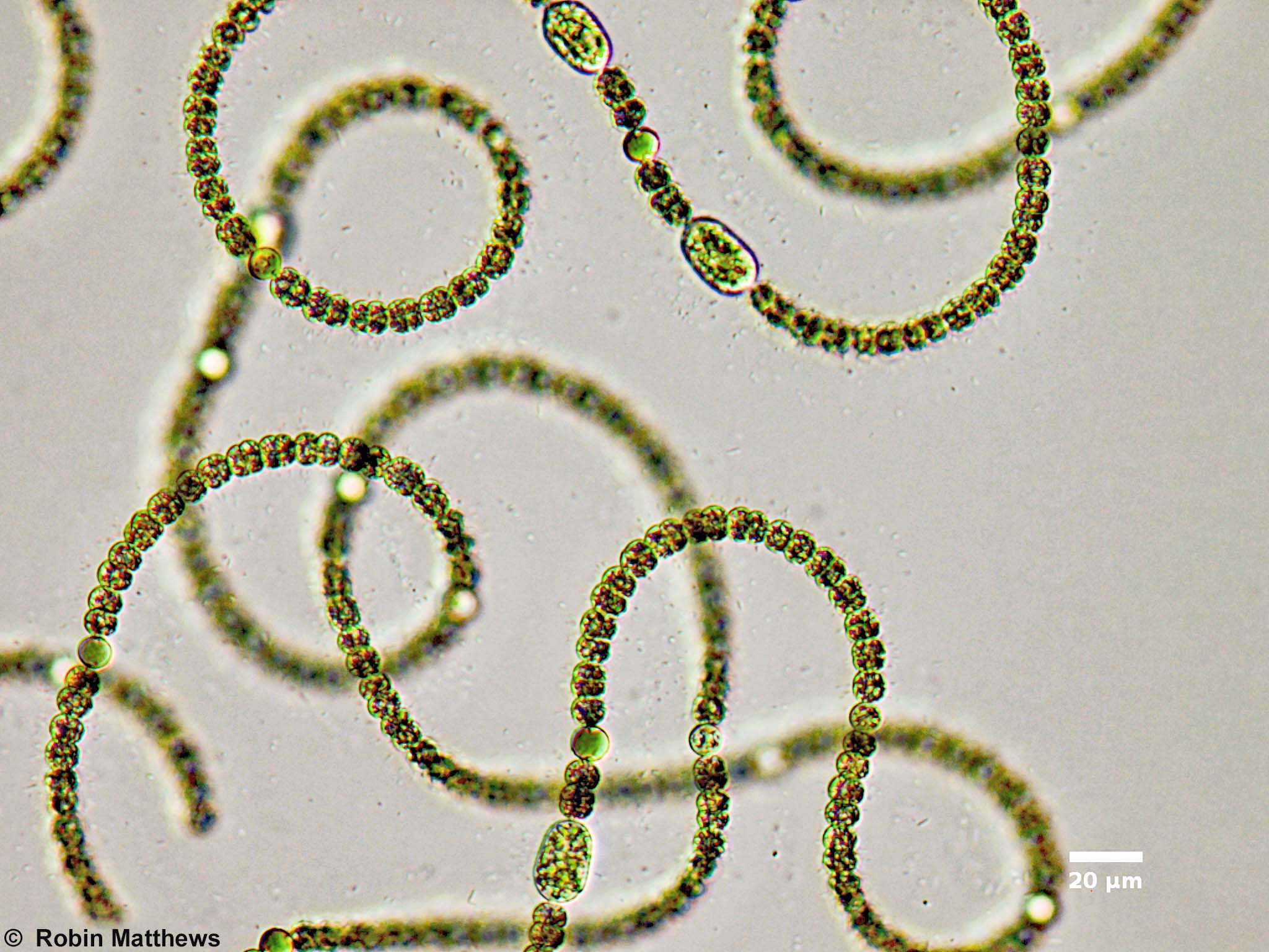 ./././Cyanobacteria/Nostocales/Aphanizomenonaceae/Dolichospermum/circinale/dolichospermum-556.jpg