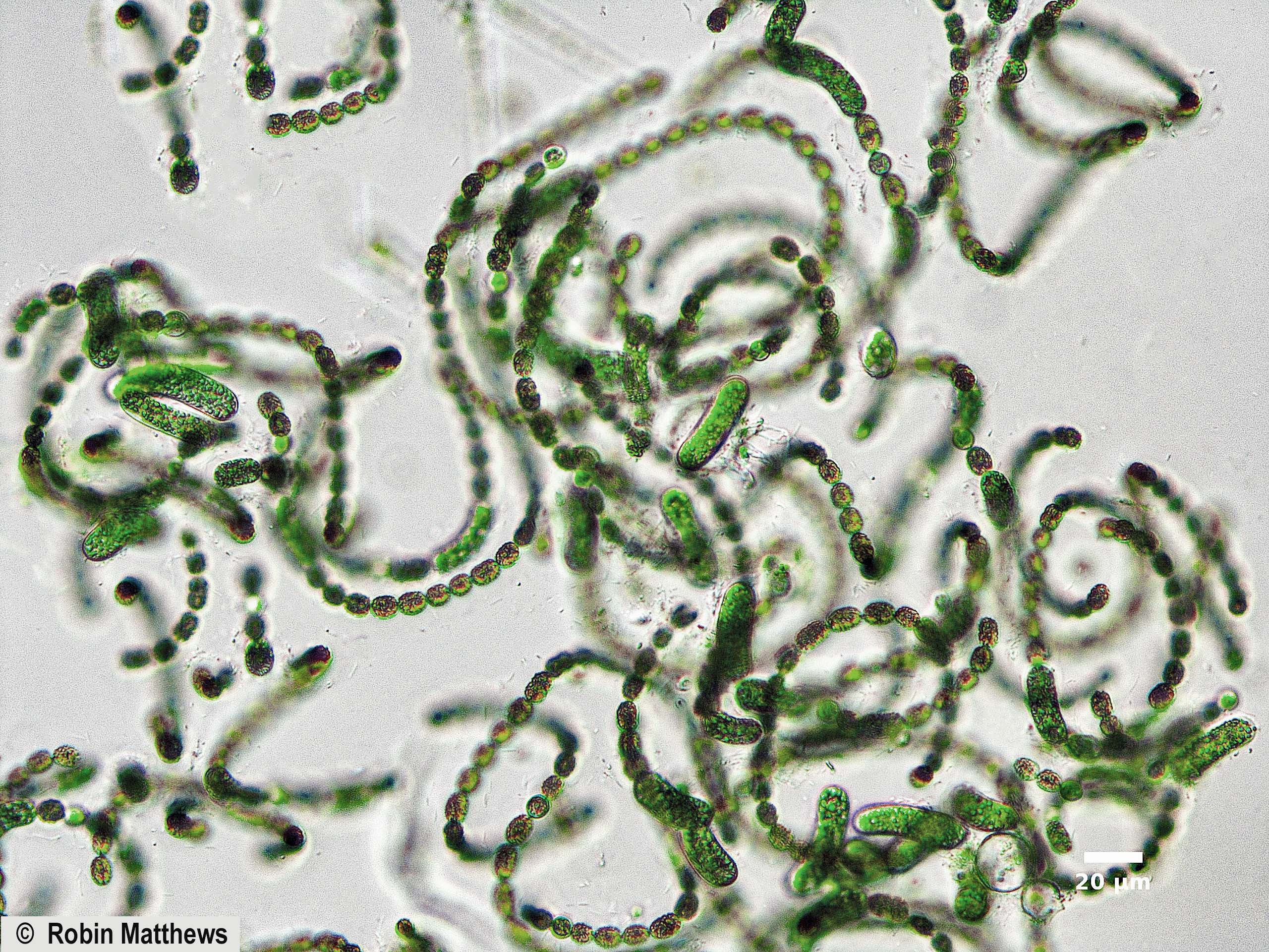 ././Cyanobacteria/Nostocales/Aphanizomenonaceae/Dolichospermum/ellipsoides/dolichospermum-563.jpg