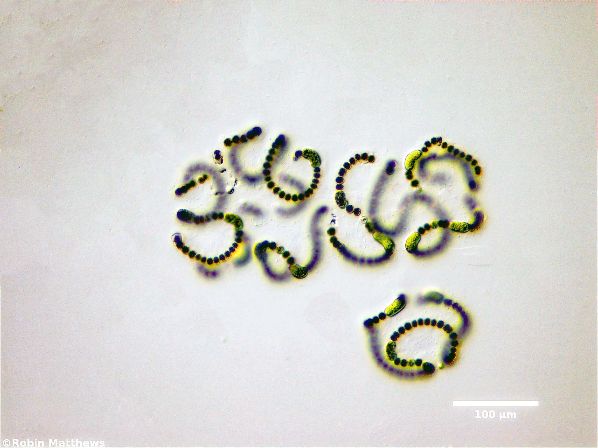 ././Cyanobacteria/Nostocales/Aphanizomenonaceae/Dolichospermum/flos-aquae/dolichospermum-567.jpg