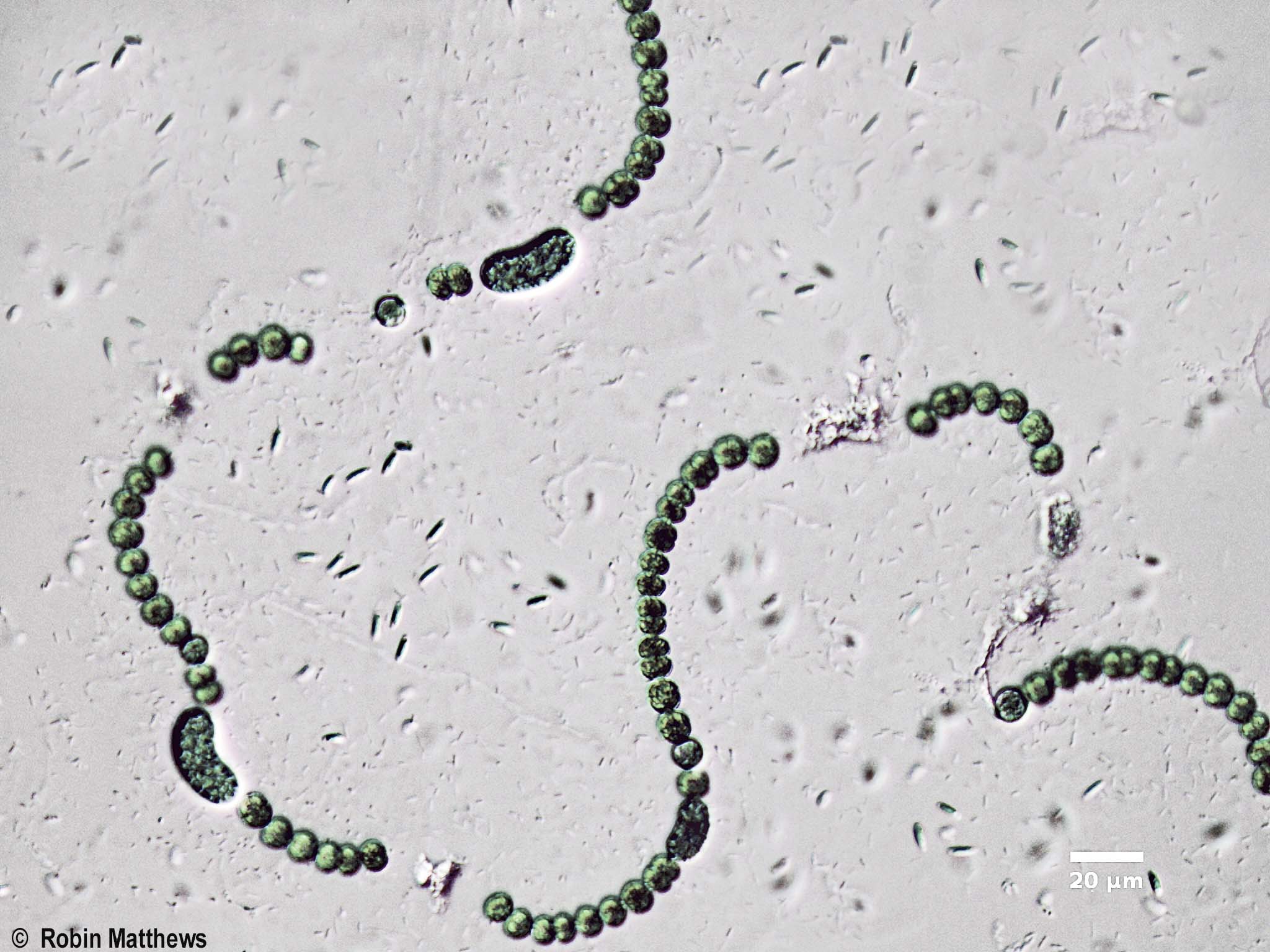 Cyanobacteria/Nostocales/Aphanizomenonaceae/Dolichospermum/flos-aquae/dolichospermum-568.jpg