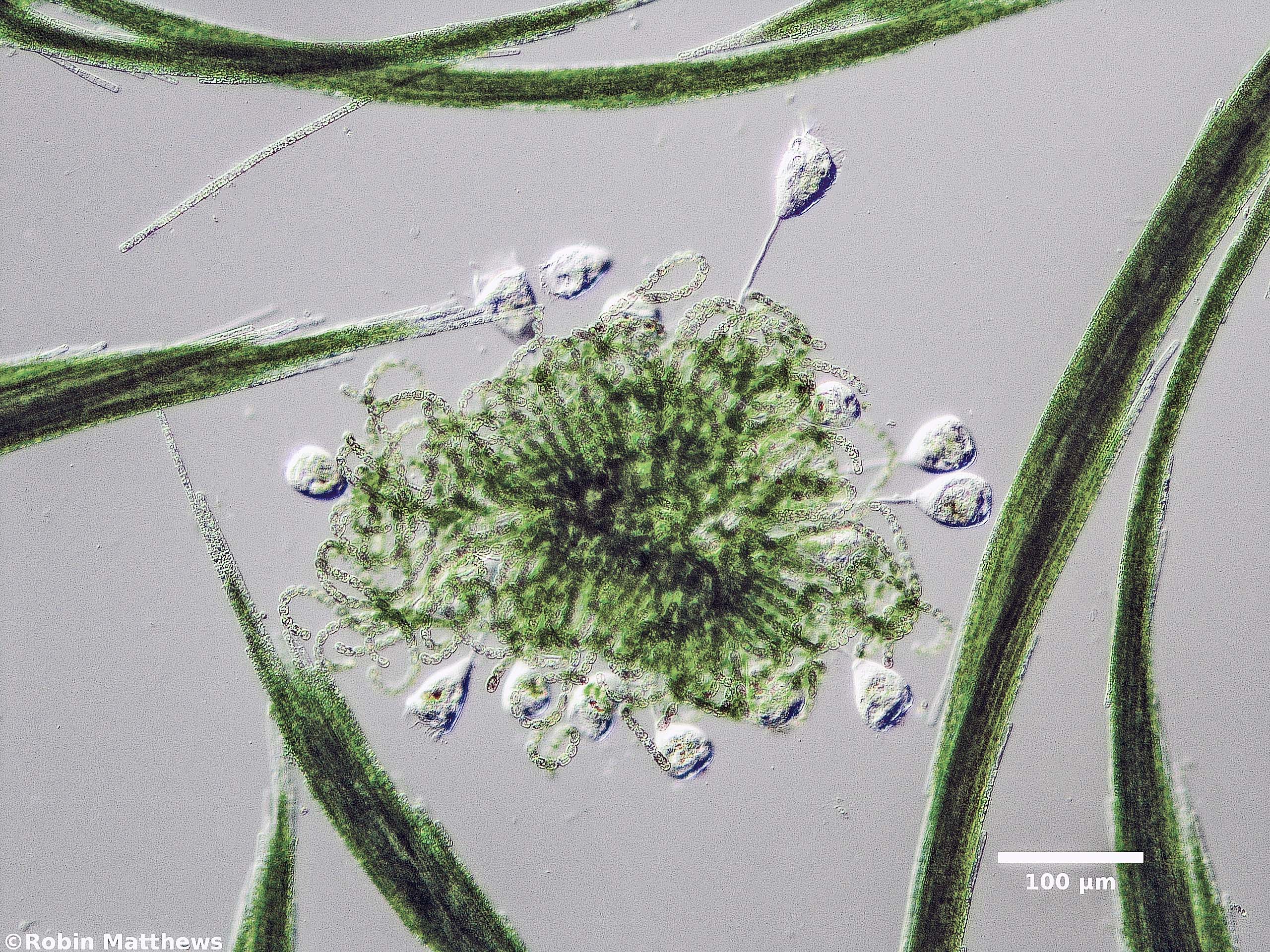././Cyanobacteria/Nostocales/Aphanizomenonaceae/Dolichospermum/lemmermannii/dolichospermum-569.jpg