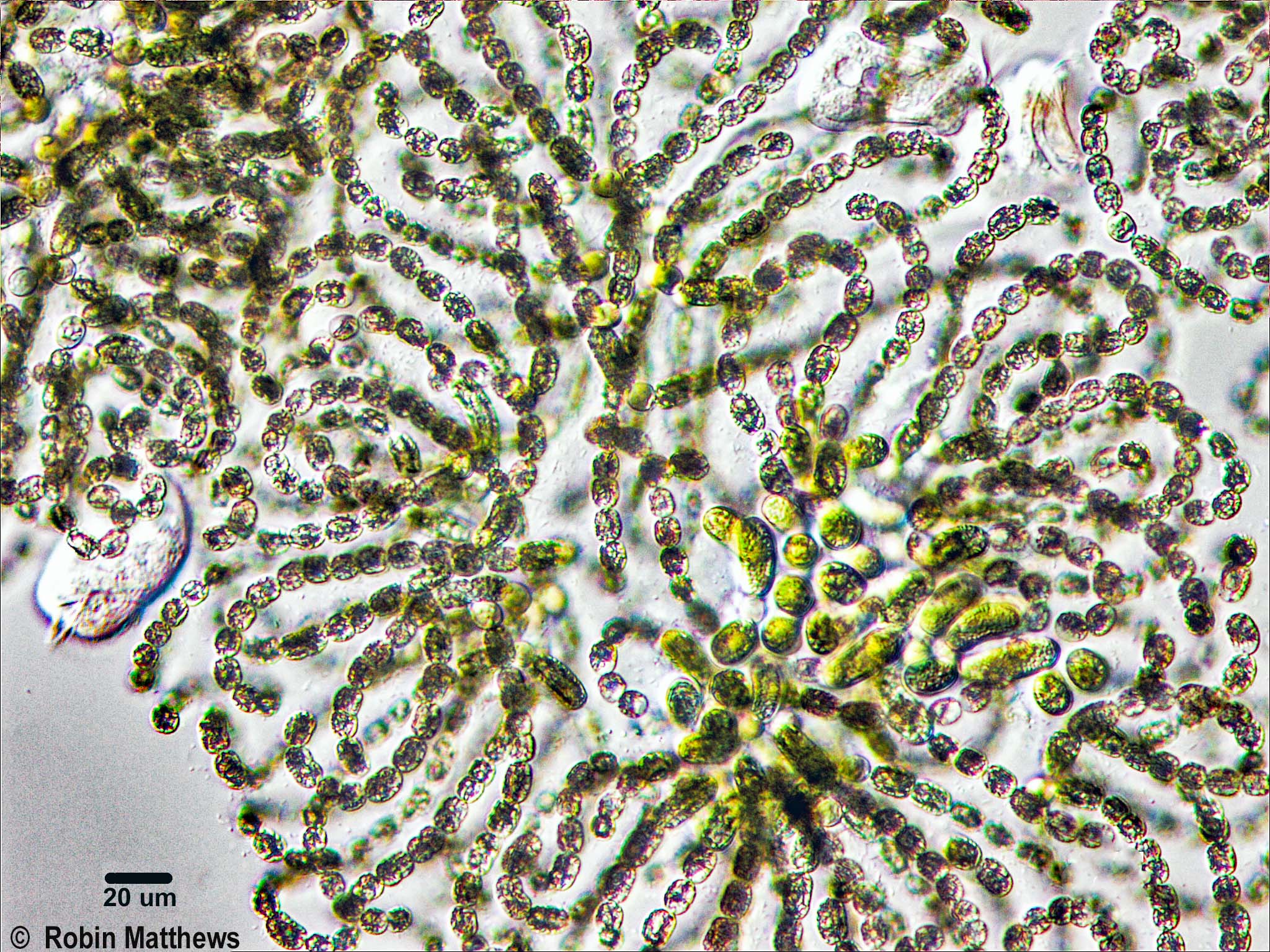 ././././Cyanobacteria/Nostocales/Aphanizomenonaceae/Dolichospermum/lemmermannii/dolichospermum-570.jpg