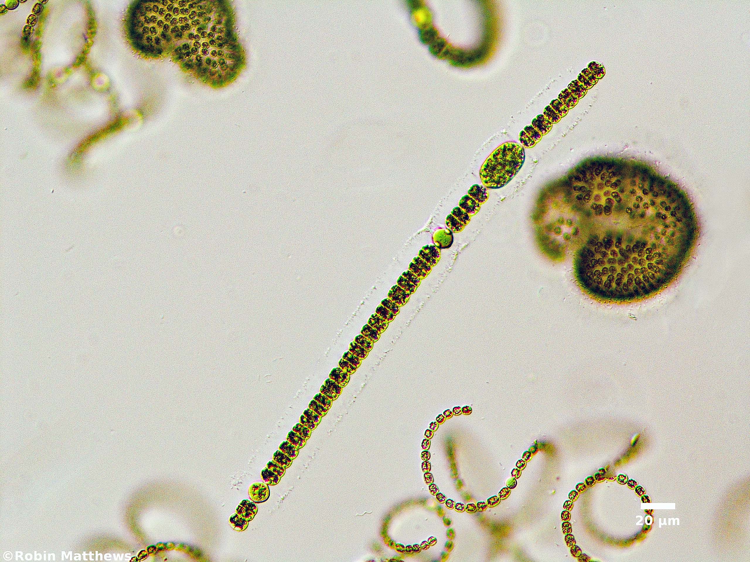././Cyanobacteria/Nostocales/Aphanizomenonaceae/Dolichospermum/planctonicum/dolichospermum-576.jpg