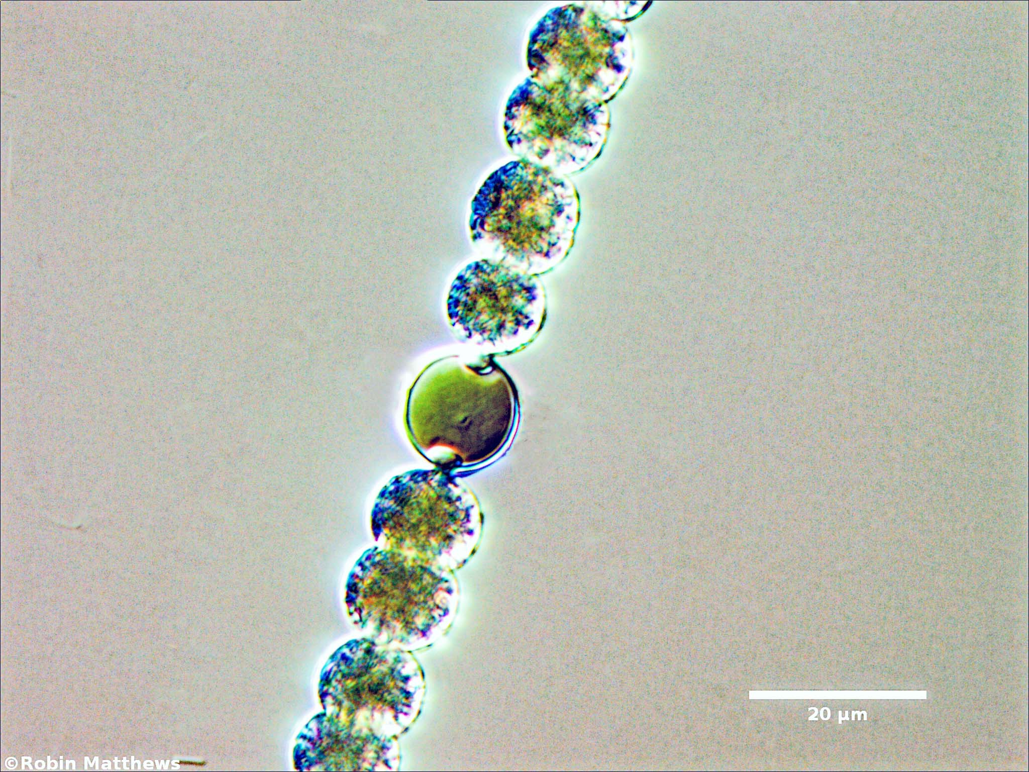 Cyanobacteria/Nostocales/Aphanizomenonaceae/Dolichospermum/planctonicum/dolichospermum-577.jpg