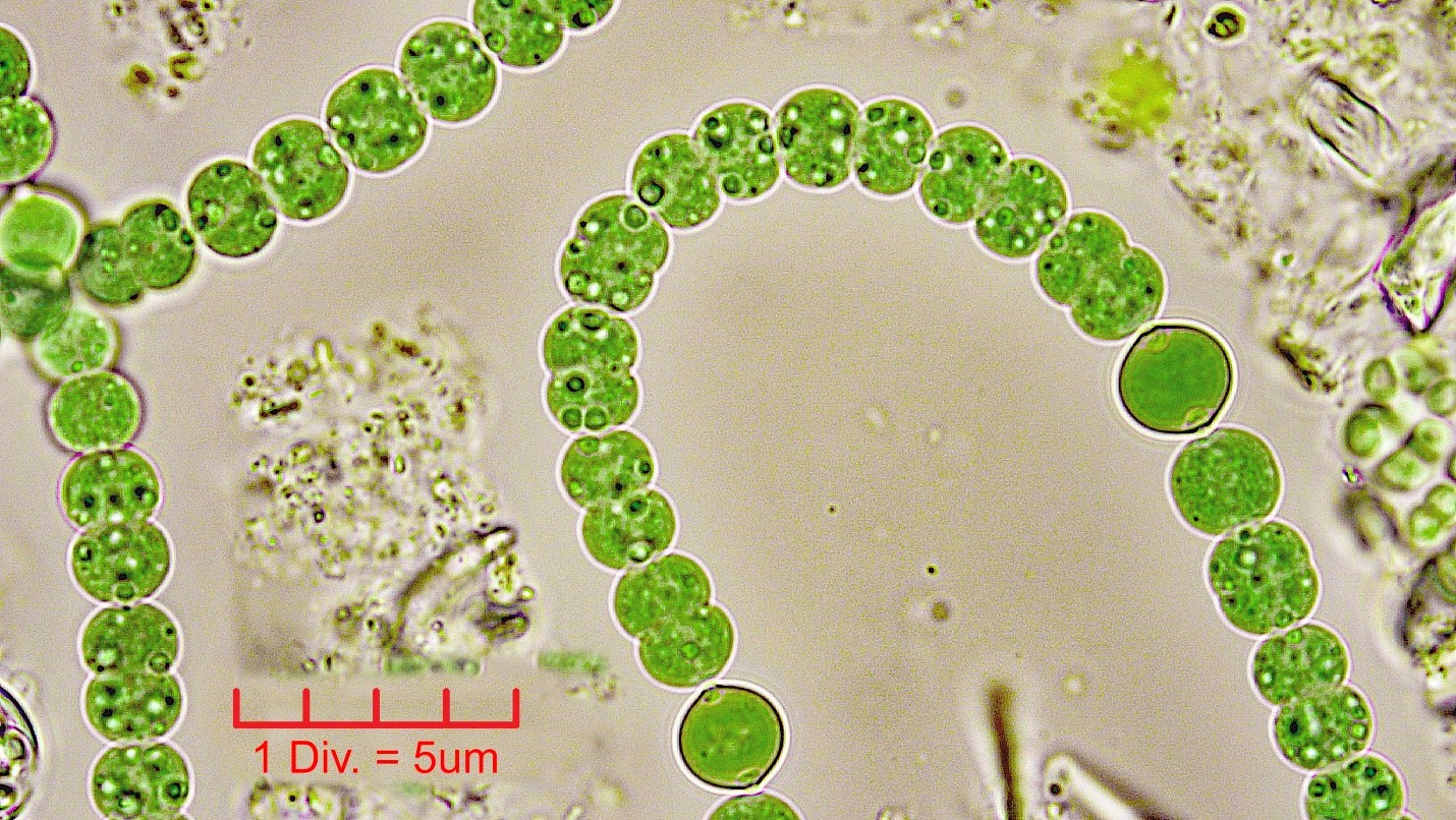././././Cyanobacteria/Nostocales/Aphanizomenonaceae/Dolichospermum/sp/dolichospermum-552.jpg