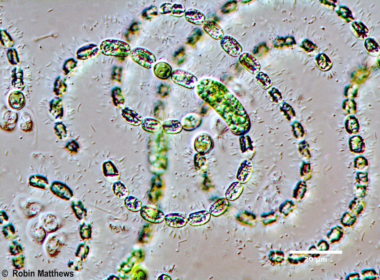 ./././Cyanobacteria/Nostocales/Aphanizomenonaceae/Dolichospermum/sp/dolichospermum-554.jpg