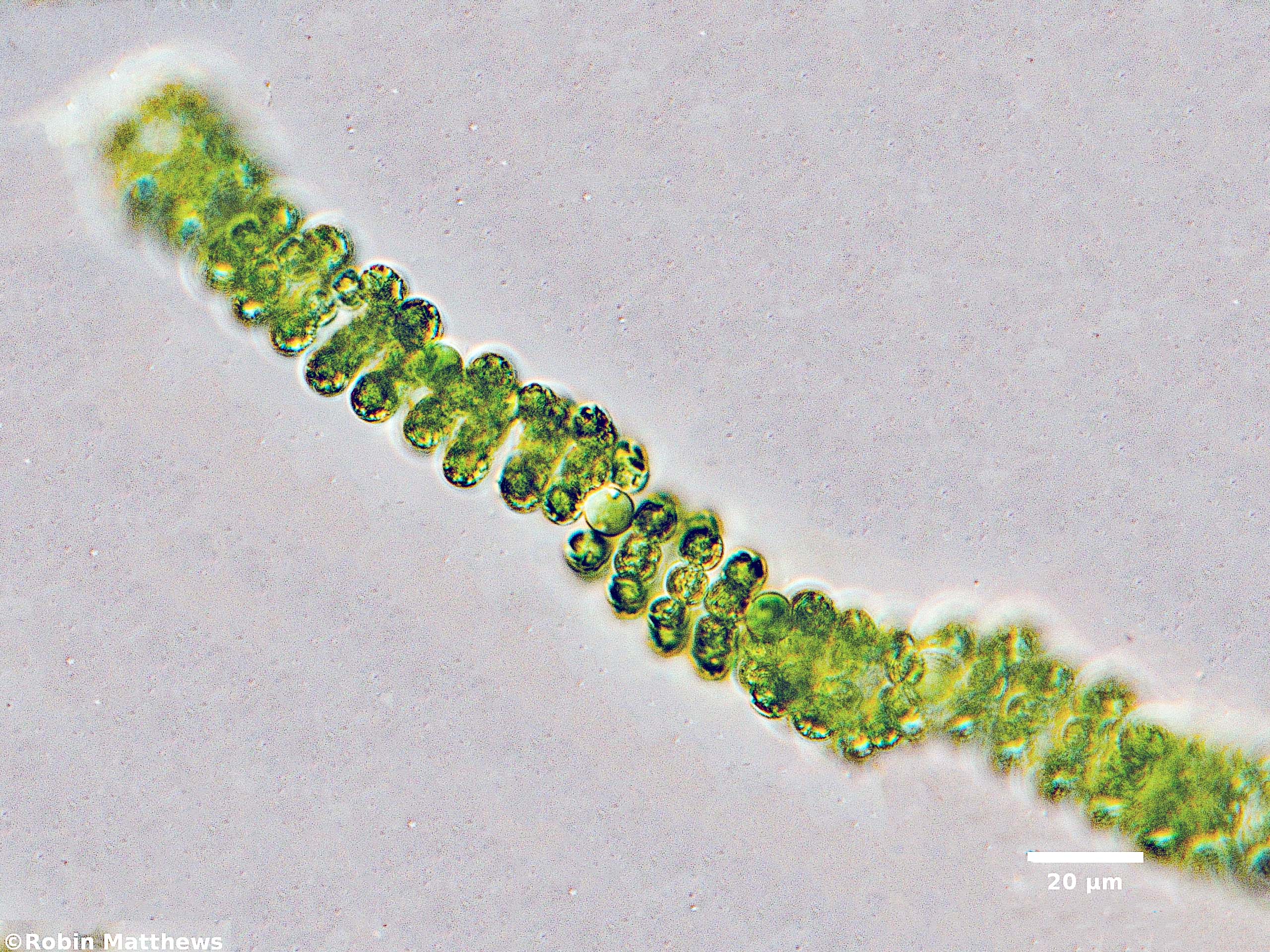 ././Cyanobacteria/Nostocales/Aphanizomenonaceae/Dolichospermum/spiroides/dolichospermum-581.jpg