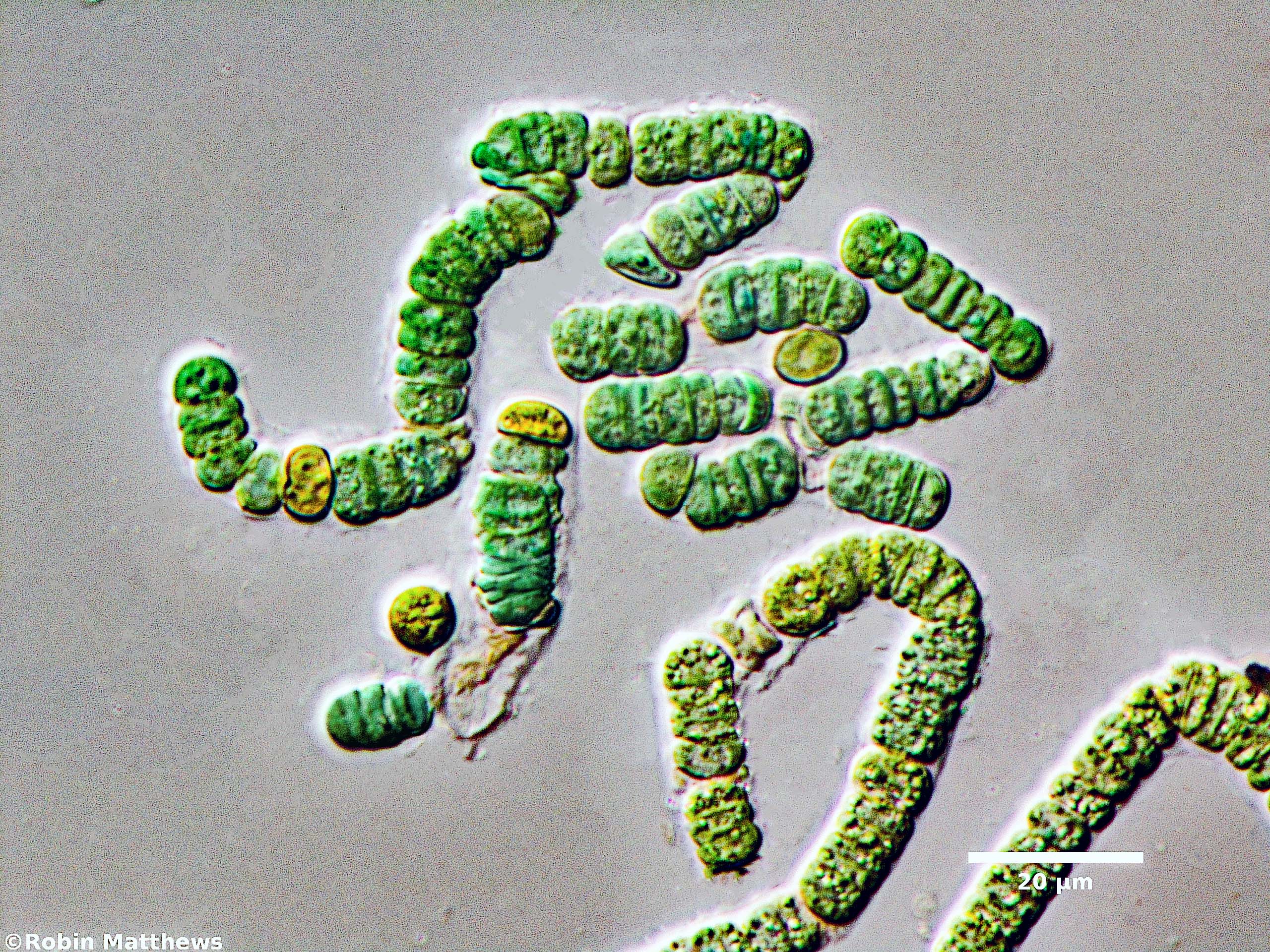 ././Cyanobacteria/Nostocales/Aphanizomenonaceae/Nodularia/sp/nodularia-586.jpg