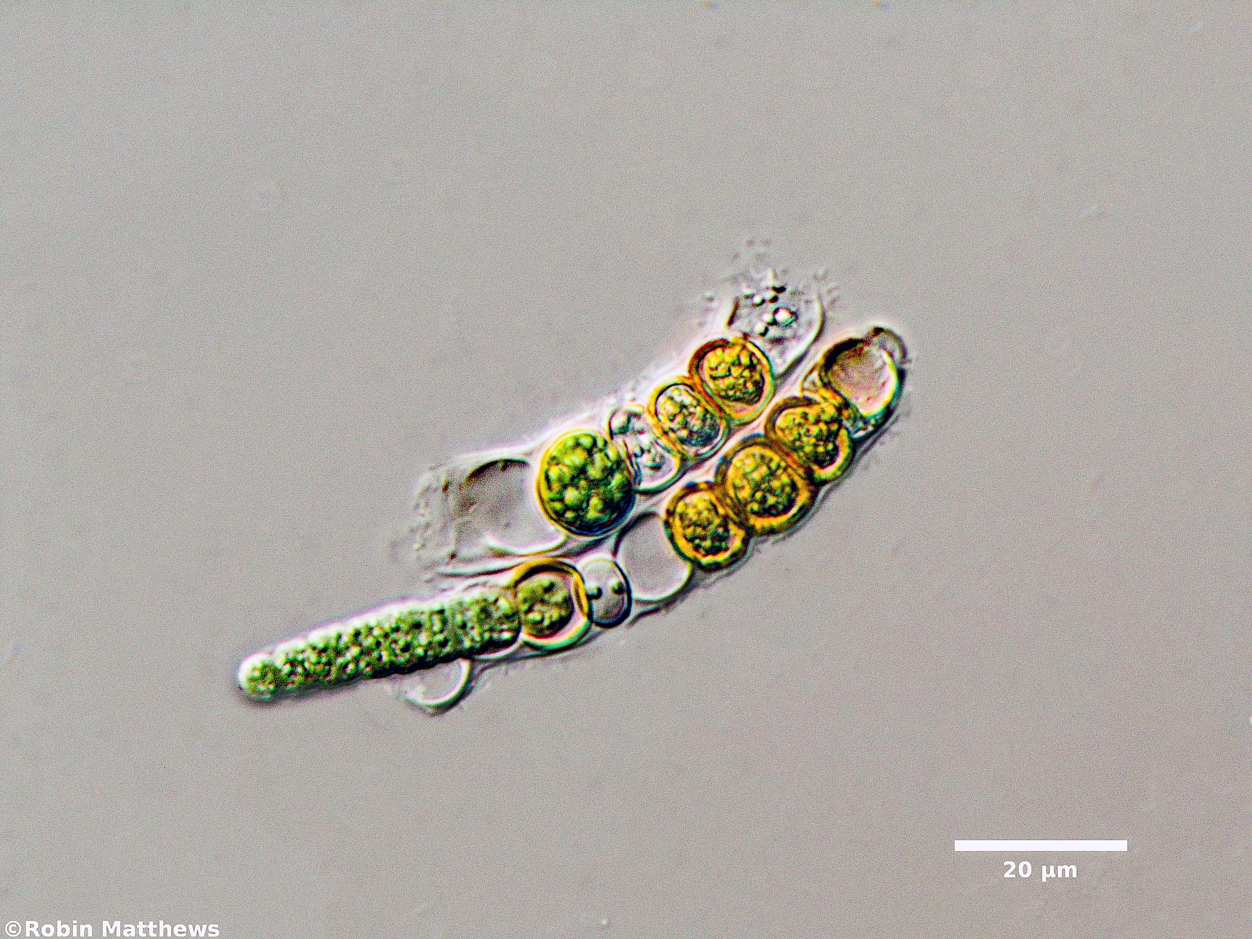 ./././Cyanobacteria/Nostocales/Aphanizomenonaceae/Nodularia/sp/nodularia-588.jpg