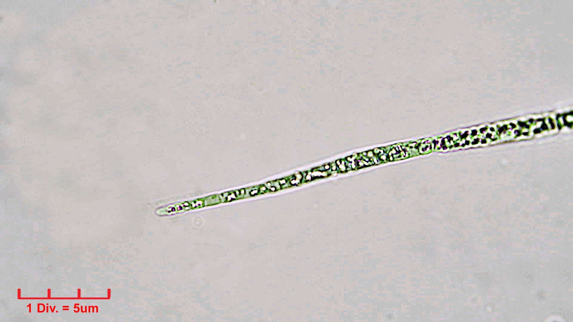 ././Cyanobacteria/Nostocales/Aphanizomenonaceae/Raphidiopsis/sp/raphidiopsis-548.jpg