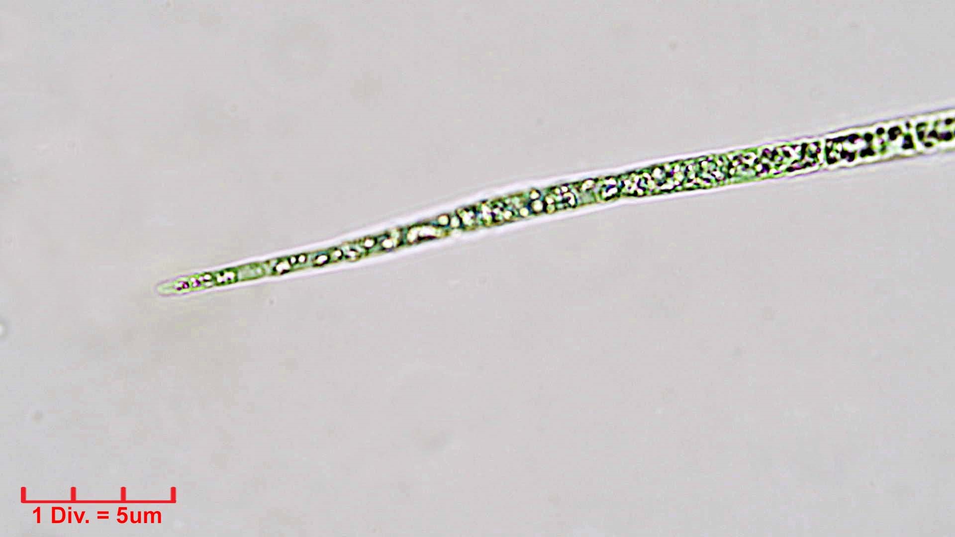 ./././Cyanobacteria/Nostocales/Aphanizomenonaceae/Raphidiopsis/sp/raphidiopsis-549.jpg