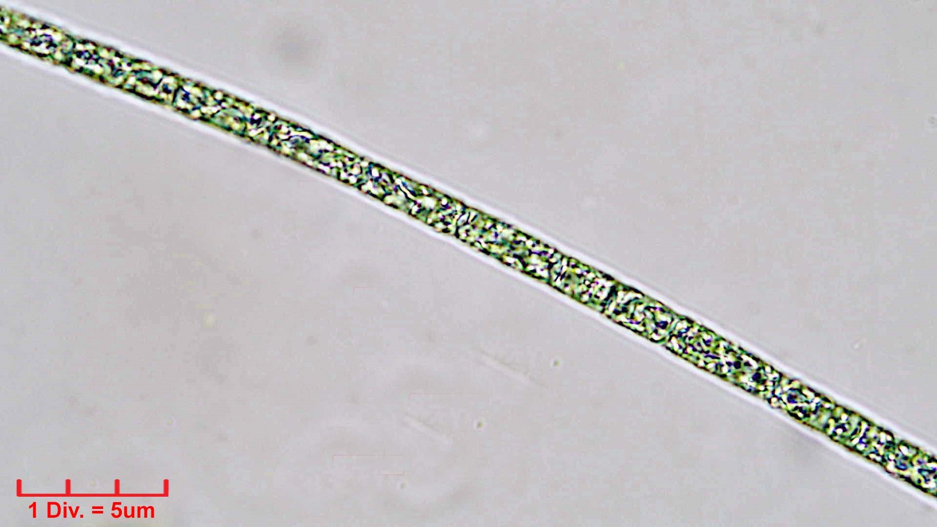 ././Cyanobacteria/Nostocales/Aphanizomenonaceae/Raphidiopsis/sp/raphidiopsis-550.jpg