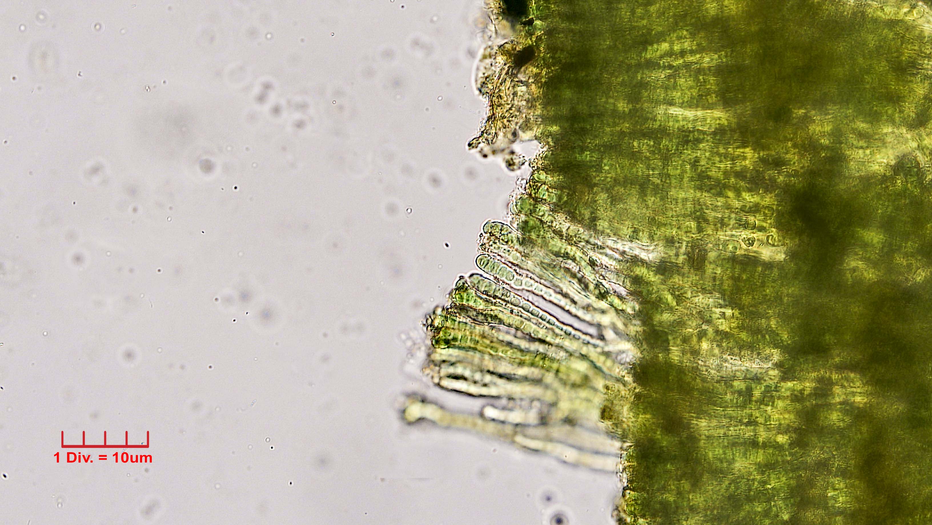 Cyanobacteria/Nostocales/Capsosiraceae/Capsosira/brebissonii/capsosira-brebissonii-515.jpg