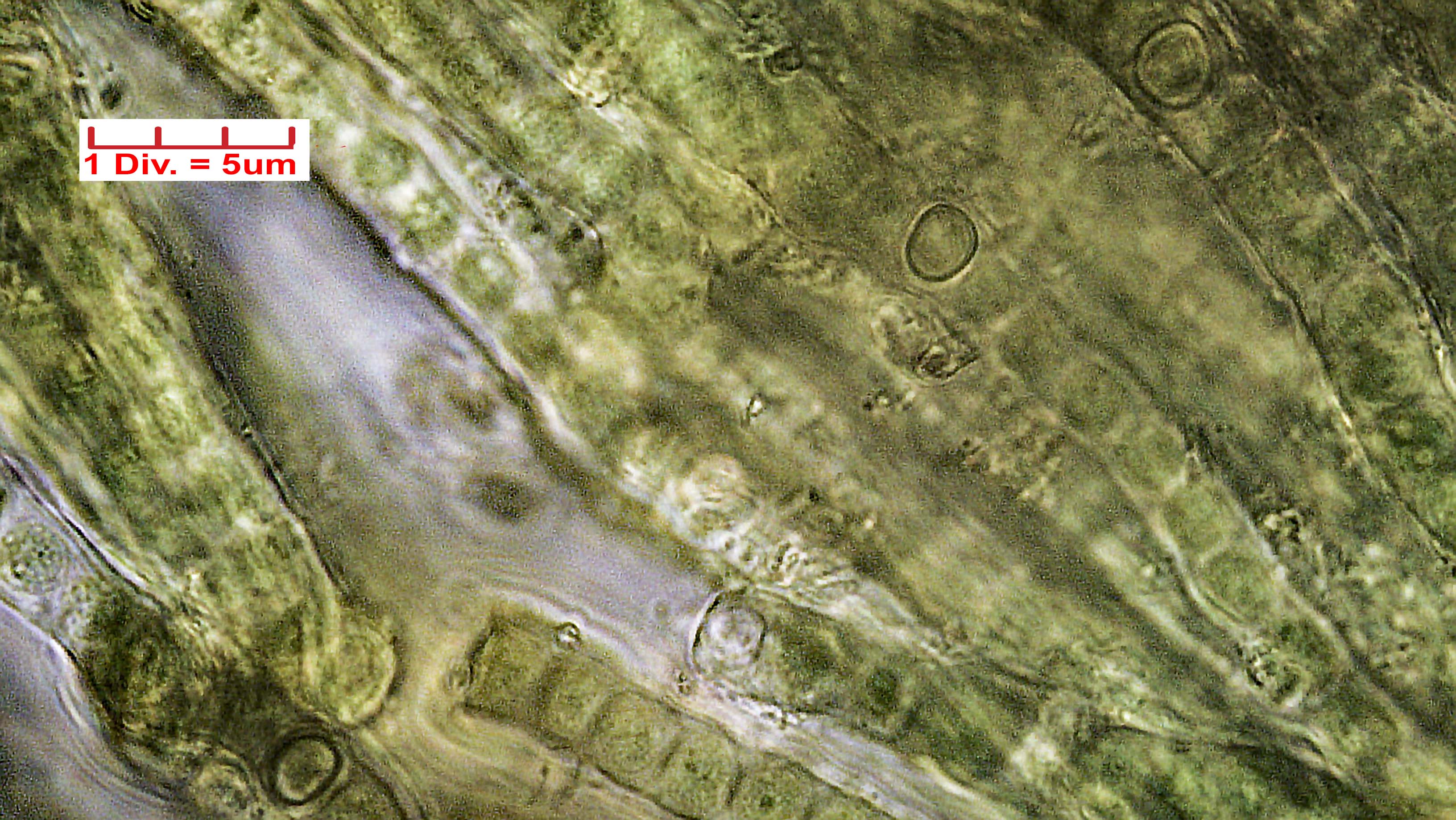 ././Cyanobacteria/Nostocales/Capsosiraceae/Capsosira/brebissonii/capsosira-brebissonii-516.jpg