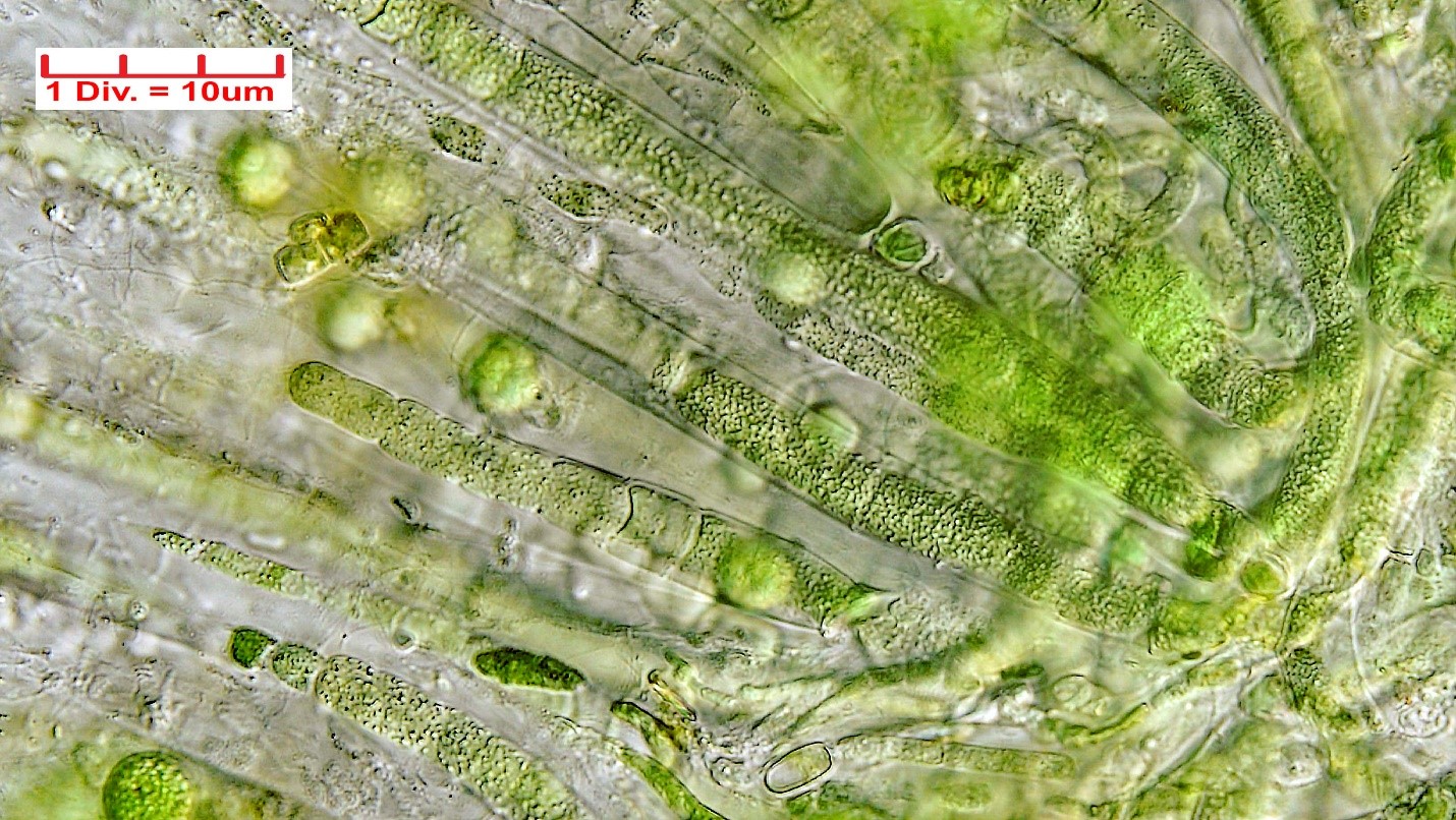 Cyanobacteria/Nostocales/Gloeotrichiaceae/Gloeotrichia/natans/gloeotrichia-natans-484.jpg