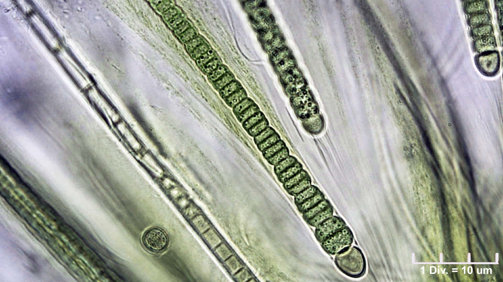 ././Cyanobacteria/Nostocales/Gloeotrichiaceae/Gloeotrichia/pisum/gloeotrichia-pisum-488.jpg