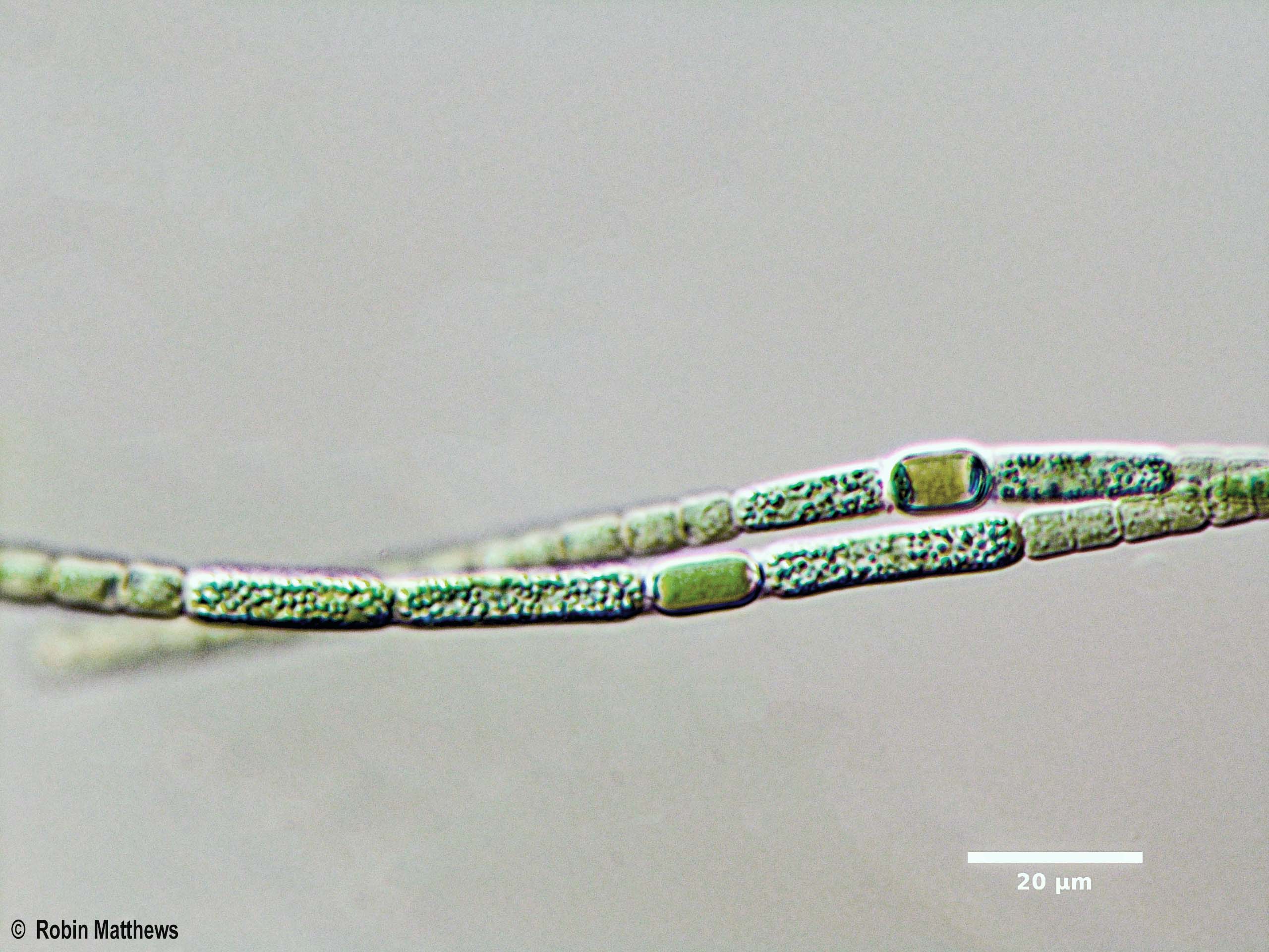 Cyanobacteria/Nostocales/Nostocaceae/Anabaena/cylindrica/anabaena-cylindrica-617.jpg