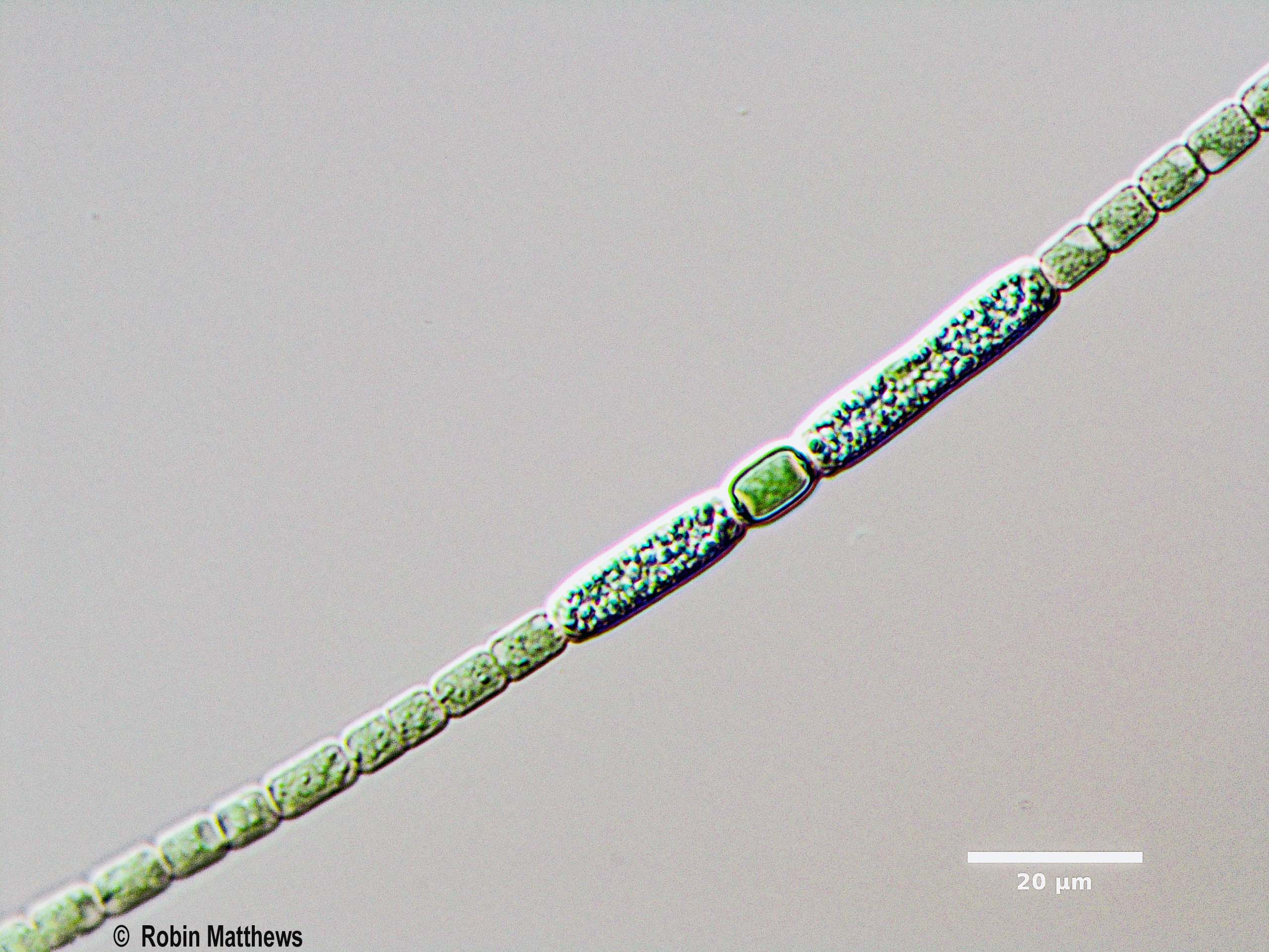 Cyanobacteria/Nostocales/Nostocaceae/Anabaena/cylindrica/anabaena-cylindrica-618.jpg