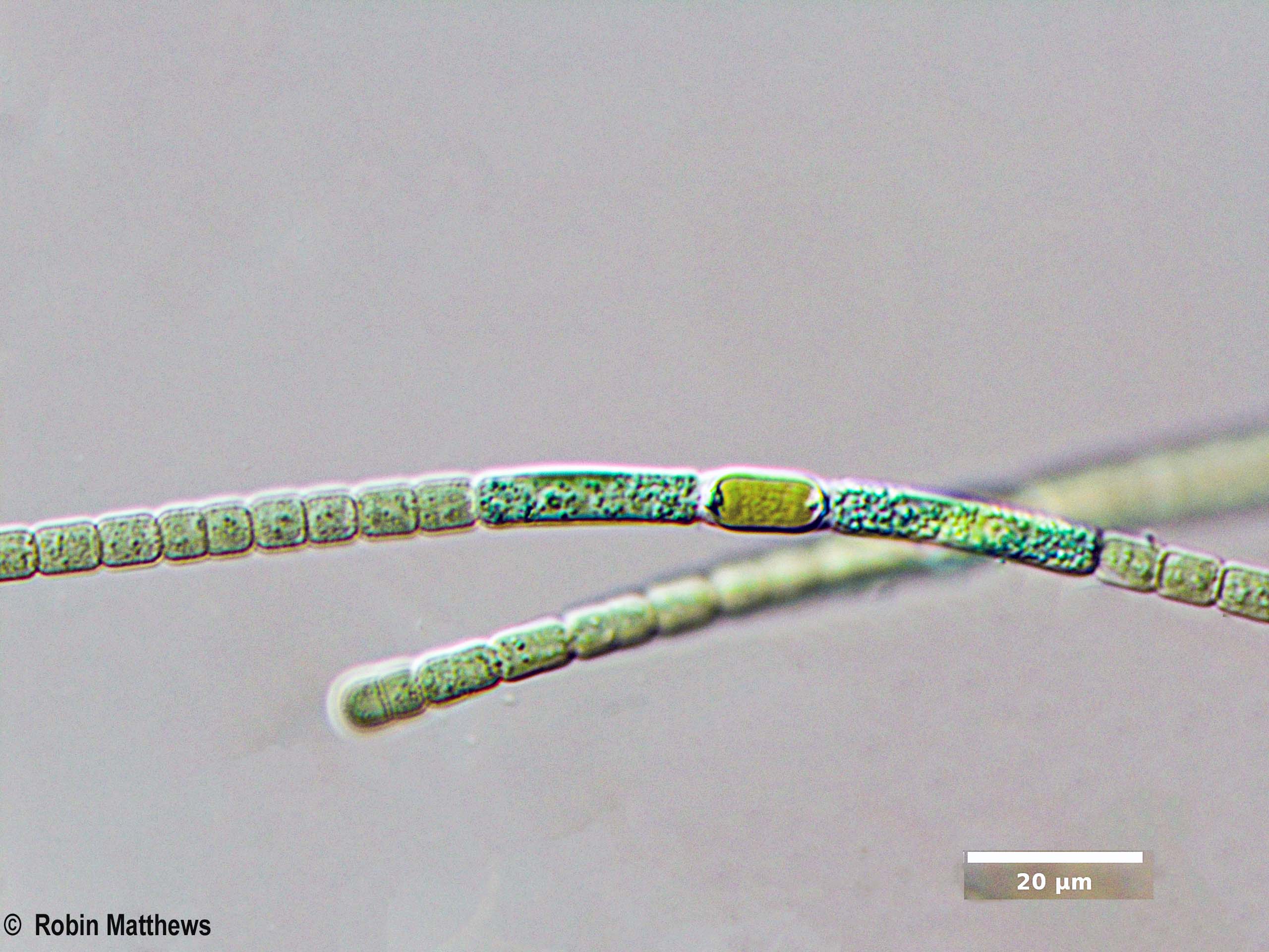 ././././Cyanobacteria/Nostocales/Nostocaceae/Anabaena/cylindrica/anabaena-cylindrica-619.jpg
