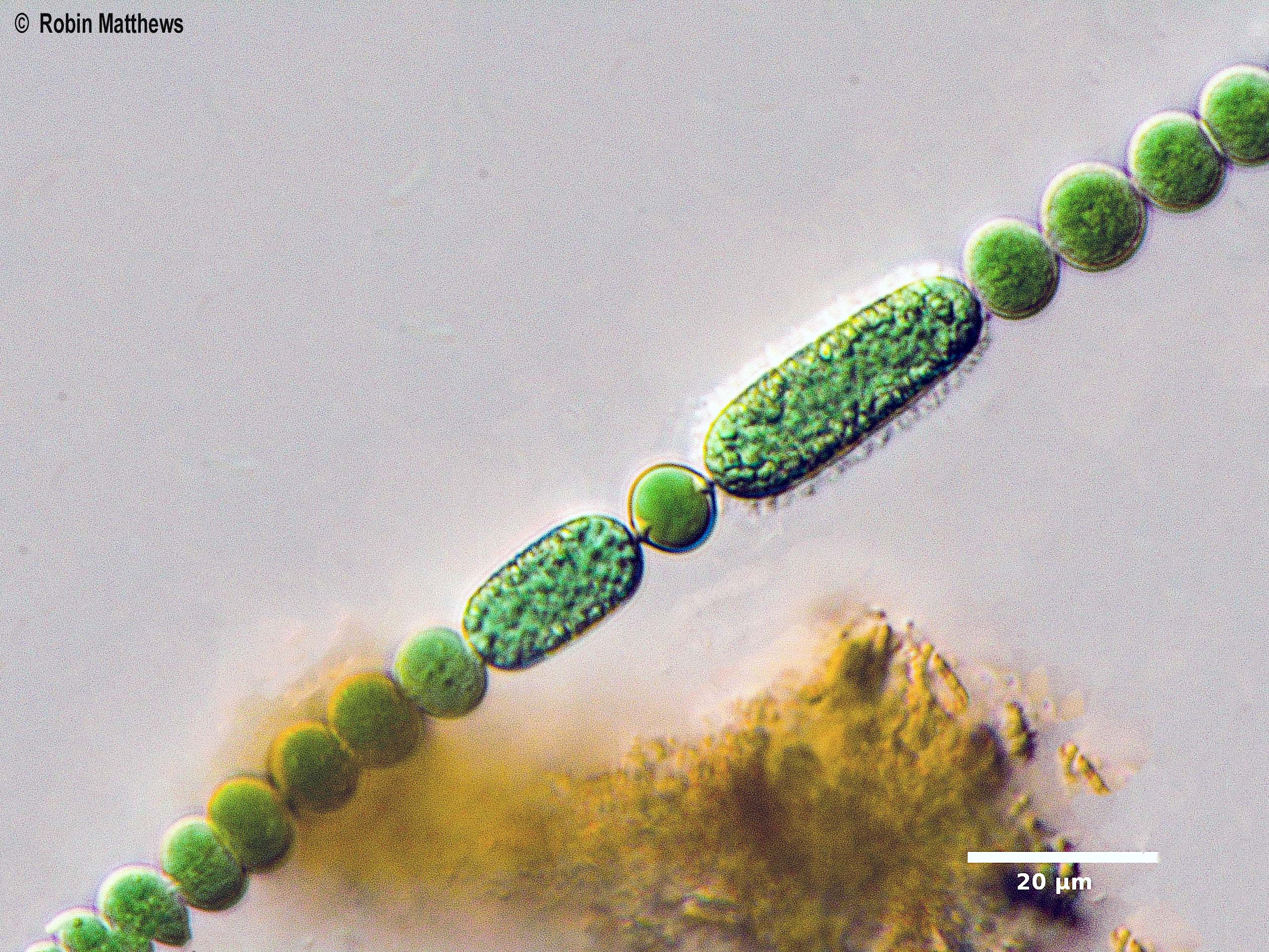 ./././Cyanobacteria/Nostocales/Nostocaceae/Anabaena/echinospora/anabaena-echinospora-620.jpg
