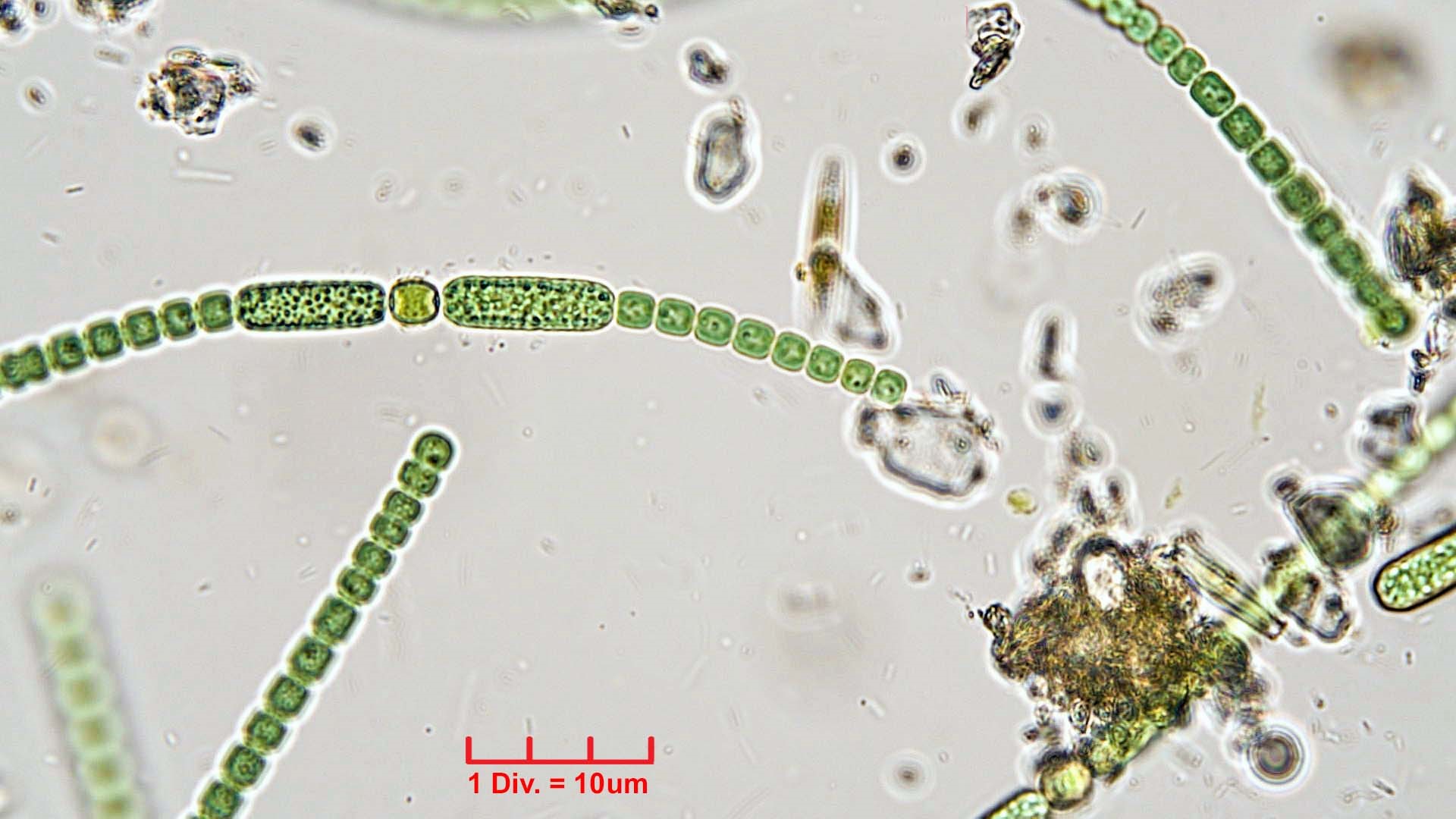 ././Cyanobacteria/Nostocales/Nostocaceae/Anabaena/oscillarioides/anabaena-oscillarioides-624.jpg