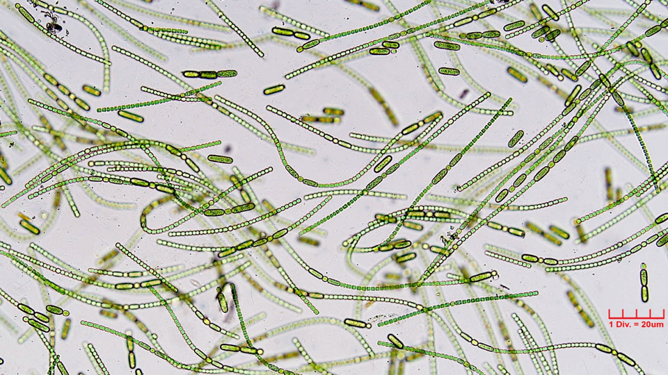 Cyanobacteria/Nostocales/Nostocaceae/Anabaena/oscillarioides/anabaena-oscillarioides-626.png