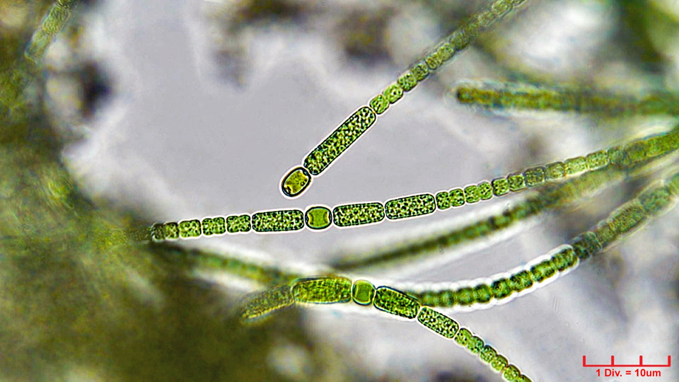 ./././Cyanobacteria/Nostocales/Nostocaceae/Anabaena/oscillarioides/anabaena-oscillarioides-627.png